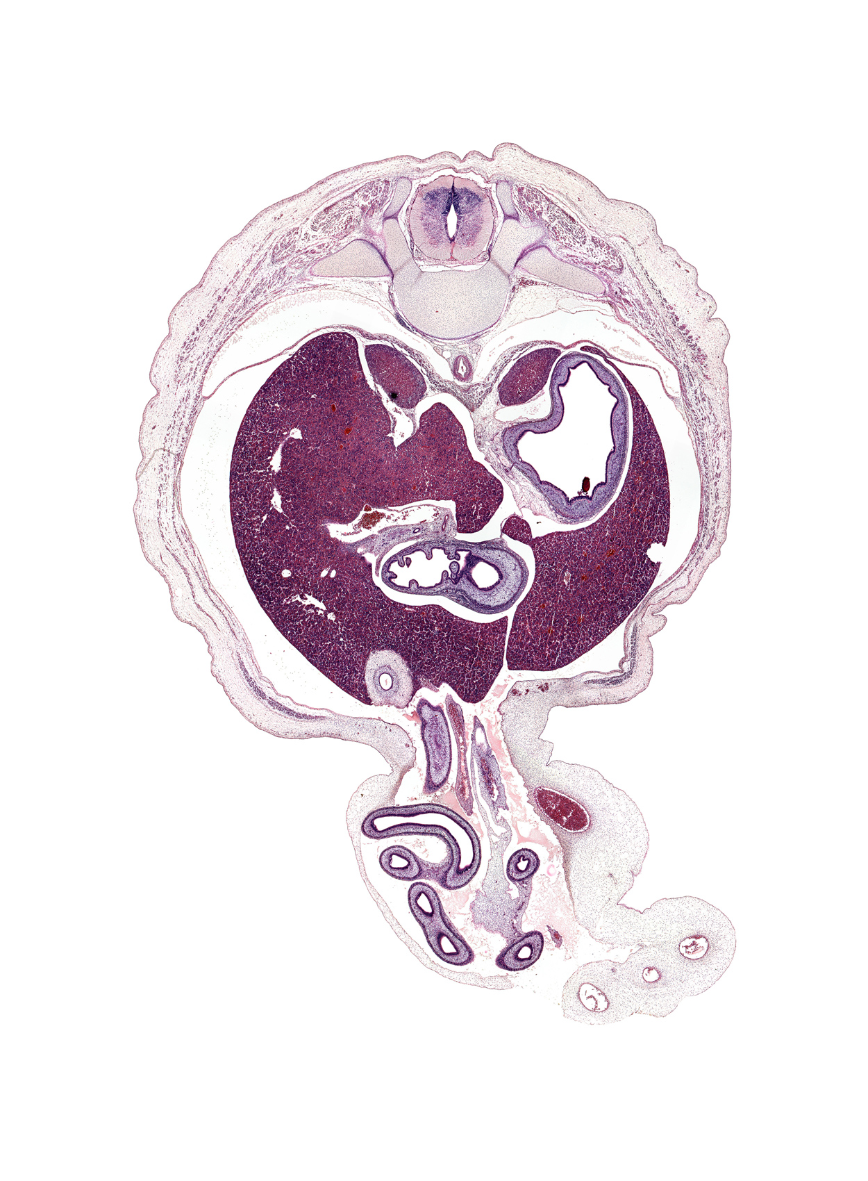 T-10 / T-11 interganglion region, allantois, aorta, artifact separation(s), cystic duct, distal limb of herniated midgut, duodenum (first part), fundus of stomach, gall bladder, hepatic portal vein, inferior vena cava, left lobe of liver, left umbilical artery, lesser curvature of stomach, lesser splanchnic nerve, proximal limb of herniated midgut, pylorus of stomach, quadrate lobe of liver, rib 11, right lobe of liver, right umbilical artery, superior mesenteric artery, superior mesenteric vein, suprarenal gland cortex, umbilical vein