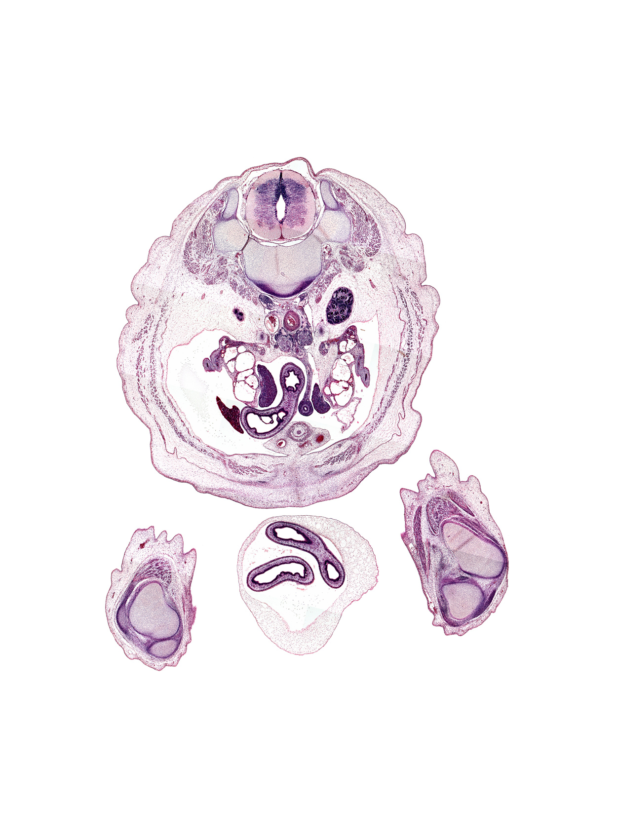 L-1 / L-2 interganglion region, aorta, caudal edge of left kidney (metanephros), caudal edge of right kidney (metanephros), caudal edge of right lobe of liver, central canal, degenerating mesonephros, dorsal funiculus, dura mater, external abdominal oblique muscle, gracilis tendon, hindgut, inferior mesenteric vessels, inferior vena cava, internal abdominal oblique muscle, lateral funiculus, medial condyle of femur, medial condyle of tibia, notochord, patella, proximal limb of herniated midgut, rectus abdominis muscle, rectus femoris muscle, sartorius muscle, subarachnoid space, testis, transversus abdominis muscle, ureter, ventral funiculus