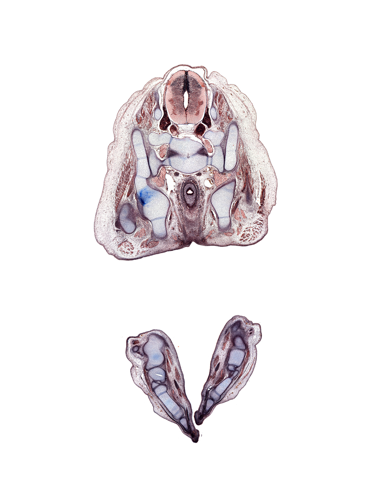 L-5 spinal ganglion, S-1 / S-2 intervertebral region, S-1 spinal ganglion, S-1 spinal nerve, calcaneum, cuboid, cuneiform 3, digit 3 (foot), extensor digitorum brevis muscle, fibularis longus and fibularis brevis tendons, gluteus medius muscle, greater  sciatic foramen, ilium, inferior rectal branch of pudendal nerve, ischial tuberosity, lateral malleolus of fibula, levator ani muscle, metatarsal 3, notochord, pelvic ganglia, plantar interosseus muscle, rectum, sciatic nerve, sympathetic trunk