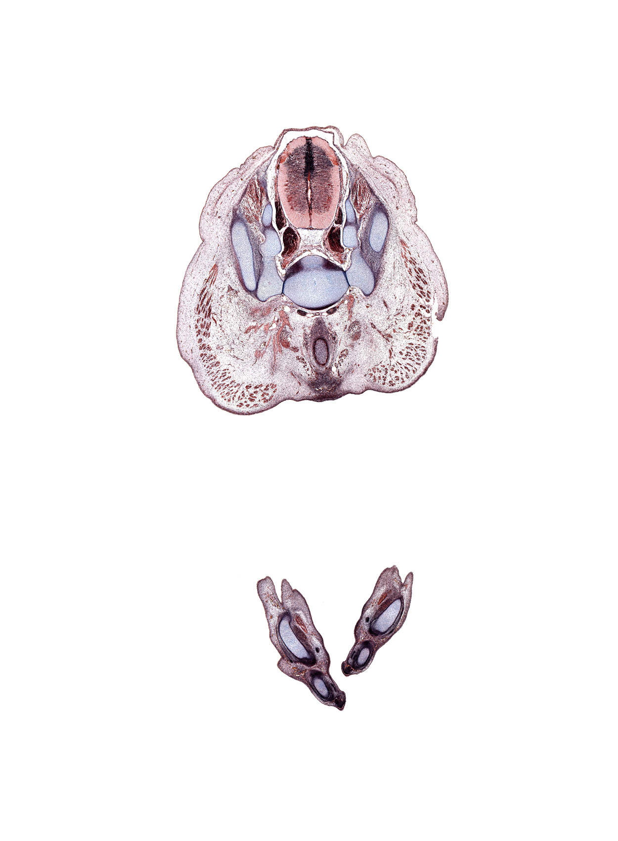 S-1 spinal ganglion, S-2 / S-3 intervertebral region, S-2 spinal ganglion, S-2 spinal nerve, abductor digiti minimi muscle, central canal, dorsal median septum, edge of rectum, flexor digitorum longus tendon, gluteus maximus muscle, iliac crest, levator ani muscle, median sacral artery, metatarsal 5, proximal phalynx of digit 5 (foot), sympathetic trunk, ventral median septum