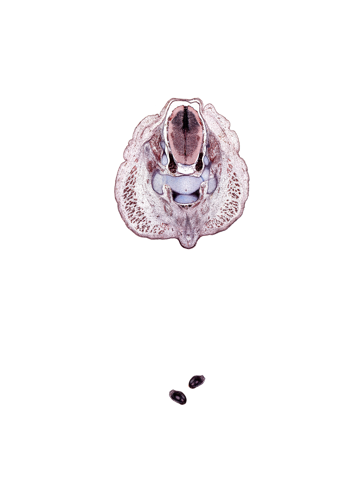 S-2 spinal ganglion, S-3 / S-4 intervertebral region, S-3 spinal ganglion, caudal eminence, centrum of S-3 vertebra, coccygeus muscle, digit 5 (foot), gluteus maximus muscle, median sacral artery, neural arch, notochord, sympathetic trunk