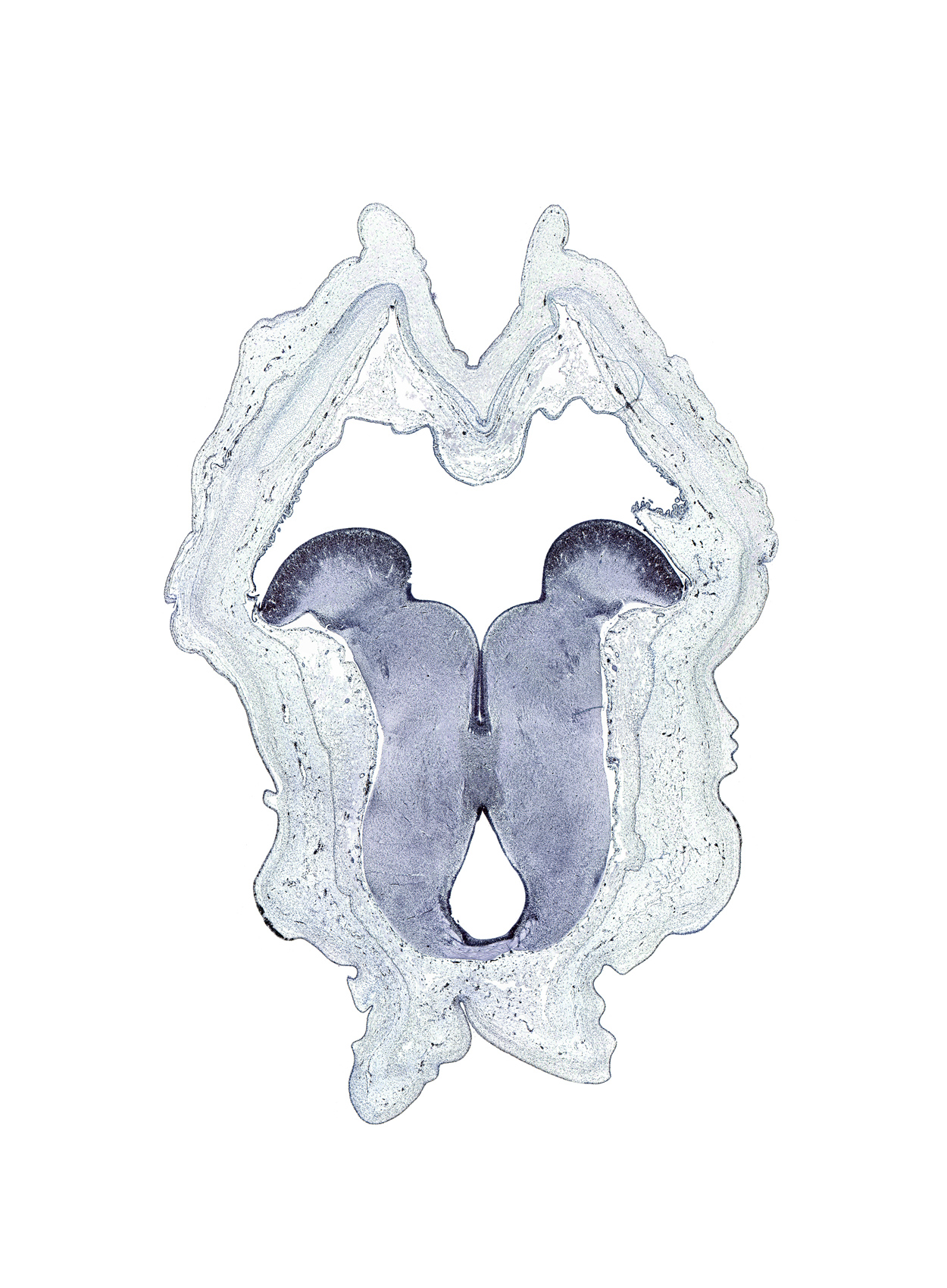 abducens nucleus, basis pedunculi of pons region (metencephalon), interpeduncular nucleus, medullary vellum, posterior commissure, red nucleus, sulcus limitans