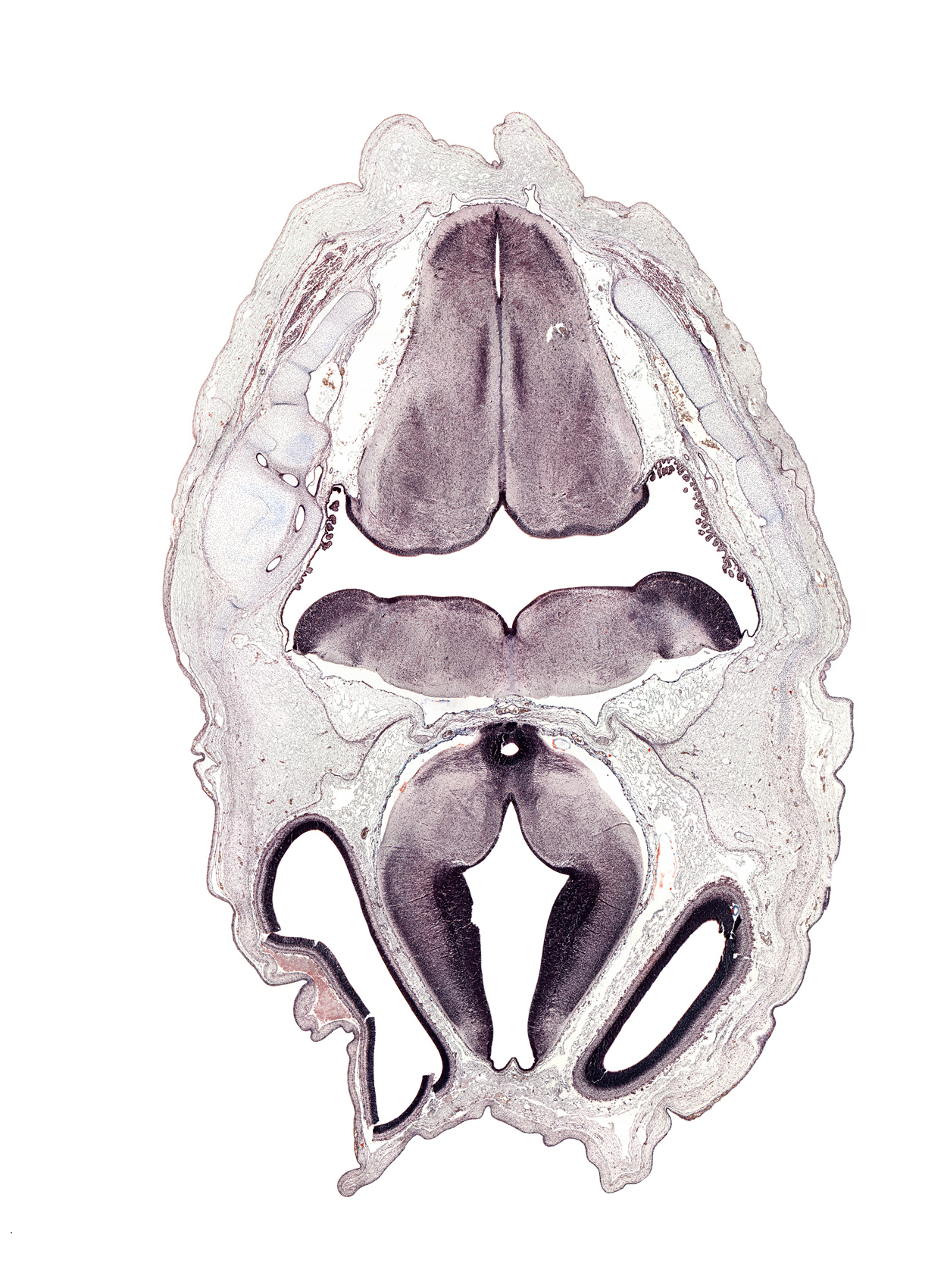 choroid plexus, diencephalon, fasciculus cuneatus, fasciculus gracilis, hypothalamic sulcus, mamillary recess, medial accessory olivary nucleus, median sulcus in floor of rhombencoel (fourth ventricle), myelencephalon (medulla oblongata), nucleus of spinal tract of trigeminal nerve, roof plate, spinal tract of trigeminal nerve (CN V), sulcus limitans, third ventricle, transverse dural sinus