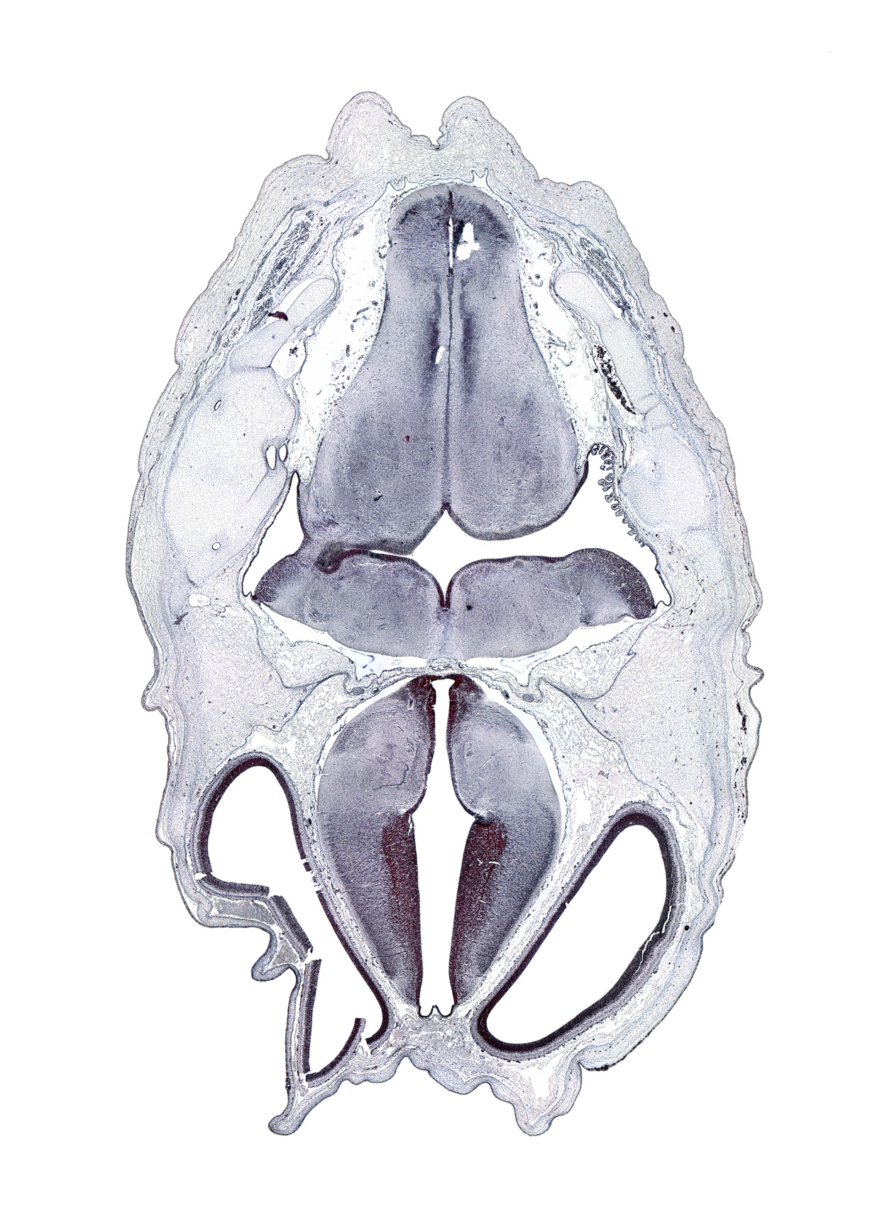 artifact space(s), artifact(s), decussation, hypothalamic sulcus, medial accessory olivary nucleus, medial longitudinal fasciculus, nucleus cuneatus, nucleus gracilis, oculomotor nerve (CN III), otic capsule cartilage, roof plate of diencephalon, sulcus dorsalis, sulcus limitans, transverse dural sinus, transverse sulcus in floor of rhombencoel (fourth ventricle)