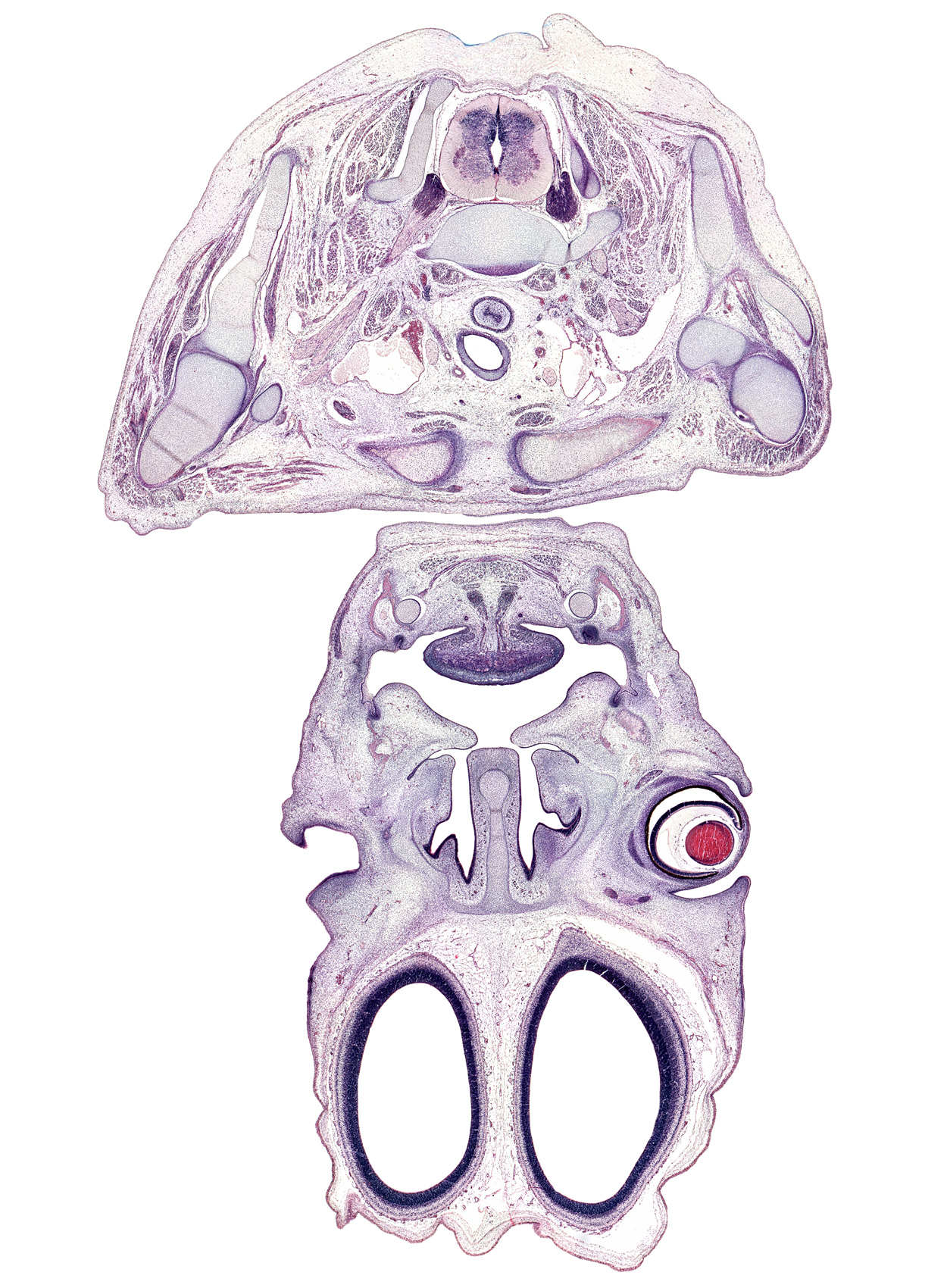 C-8 spinal ganglion, anterior scalene muscle, body of tongue, centrum of C-7 vertebra, cerebral vesicle (hemisphere), clavicle, common carotid artery, coracoid process of scapula, cortical plate, dental lamina, edge of olfactory bulb, esophagus, falx cerebri region, glenohumeral joint, internal jugular vein, labiogingival lamina, middle scalene muscle, middle trunk of brachial plexus (C-7), nasal capsule cartilage, nasal septal cartilage, nasolacrimal duct, palatine shelf, rhomboid minor muscle, short head of biceps brachii muscle, sternocleidomastoid muscle, sternohyoid muscle, sternothyroid muscle, tooth bud(s), trachea, upper trunk of brachial plexus (C-5, C-6), vagus nerve (CN X)
