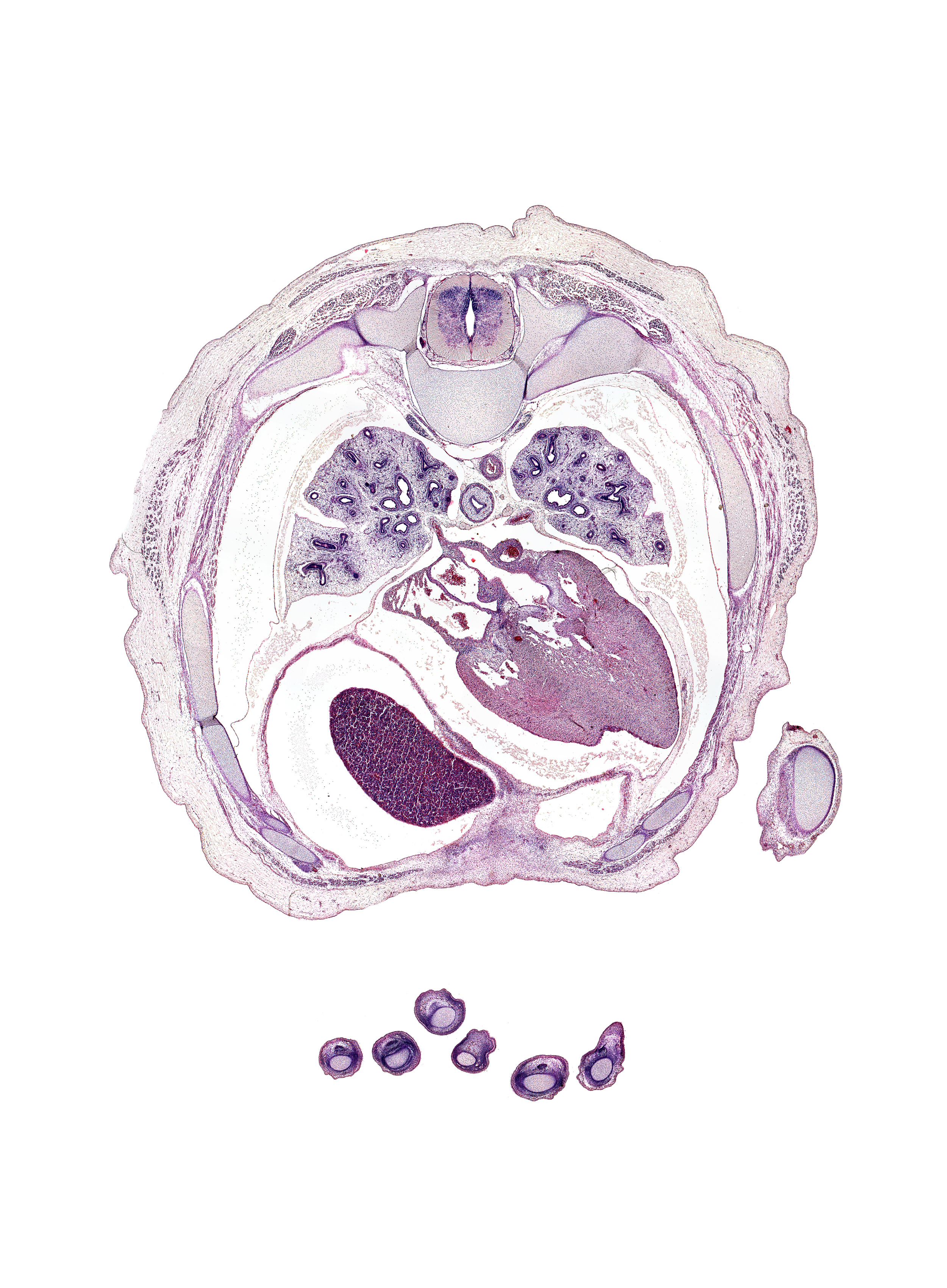 T-5 / T-6 interganglion region, apex of heart, central tendon of diaphragm, coronary sinus, distal phalynx of left digit 3 (middle finger), esophageal nerve plexus, head of rib 6, left lower pulmonary vein, lower lobe of left lung, lower lobe of right lung, middle lobe of right lung, oblique fissure, pericardial cavity, pericardial sac, peritoneal cavity, rib 6, rib 7, rib 8, right lobe of liver, right lower pulmonary vein, upper lobe of left lung