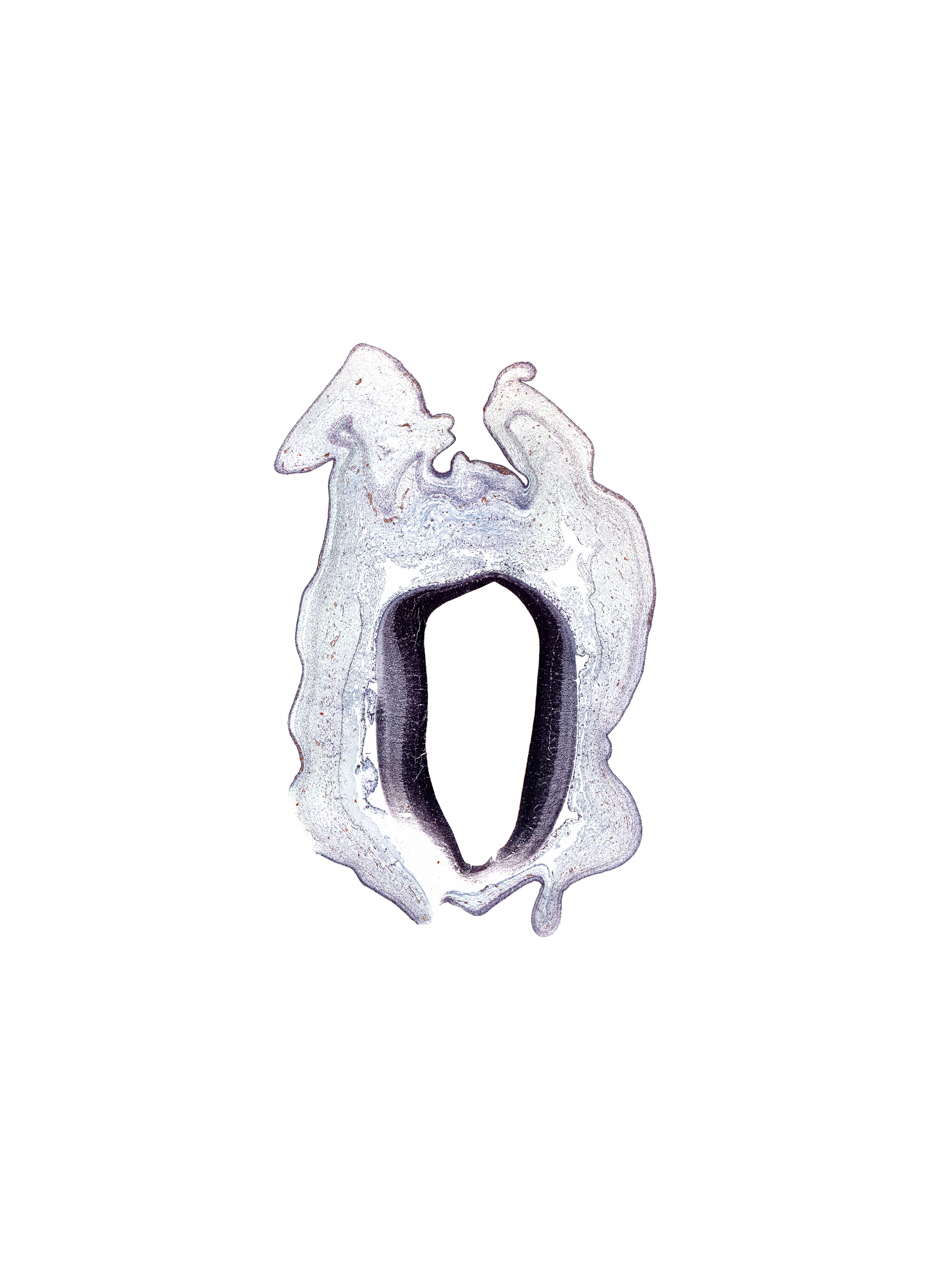 alar plate of mesencephalon, artifact(s), cerebral aqueduct (mesocoele), roof plate