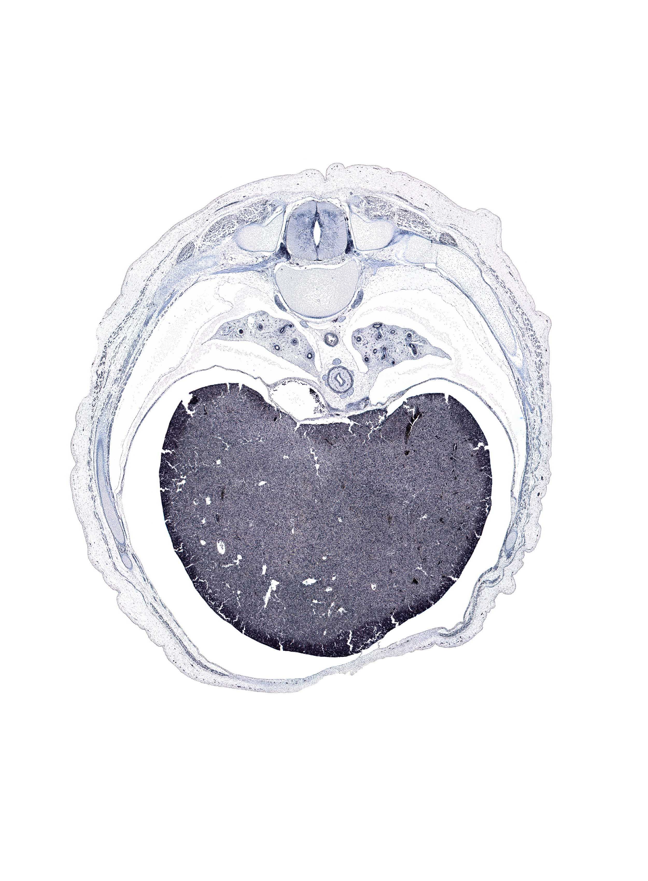 T-8 spinal ganglion, artifact(s), azygos vein anastomosis, central canal, greater splanchnic nerve, intervertebral foramen, left lobe of liver, muscular part of diaphragm, neural arch of T-8 vertebra, peritoneal cavity, pulmogenic mesenchyme, rectus abdominis muscle, rib 8, rib 9, right lobe of liver, supra-umbilical part of abdominal wall, sympathetic trunk, transverse process of T-8 vertebra