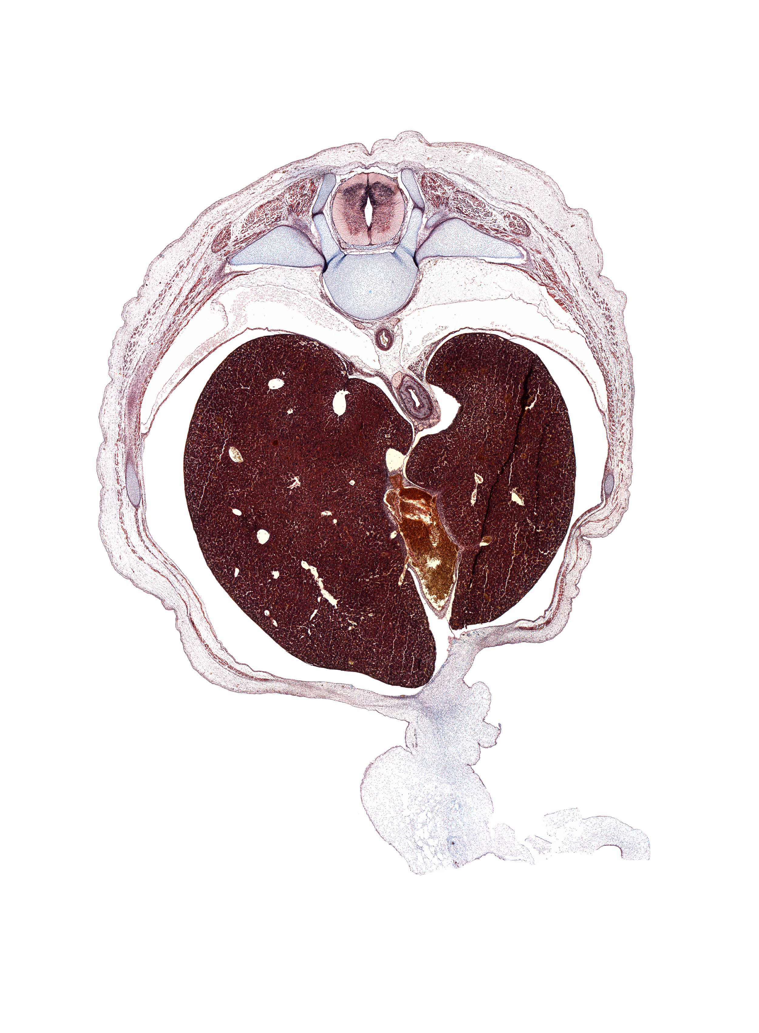 T-9 / T-10 interganglion region, afferent hepatic vein, aorta, costal margin, ductus venosus, esophageal hiatus in diaphragm, external abdominal oblique muscle, inferior vena cava, intermediate zone, internal abdominal oblique muscle, left lobe of liver, loose mesenchyme, marginal zone, posterior gastric nerve (CN X), rib 10, transversus abdominis muscle, umbilical cord, ventricular zone