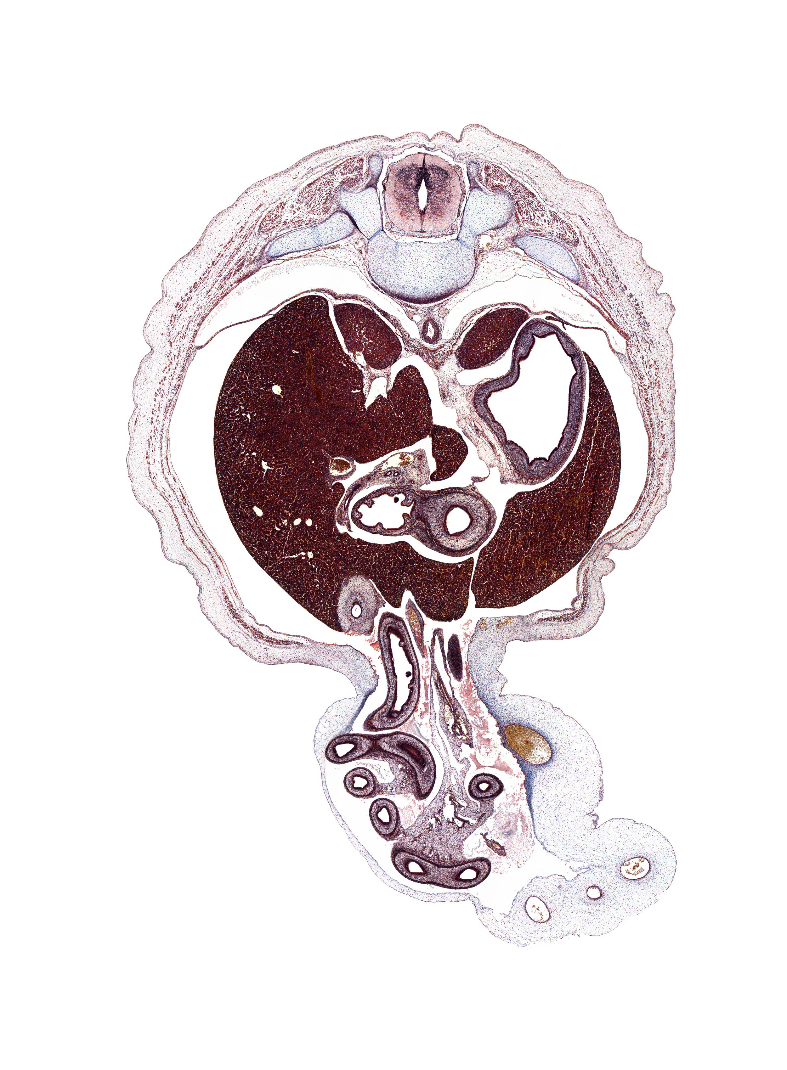 T-10 / T-11 interganglion region, allantois, aorta, azygos vein, cystic duct, distal limb of herniated midgut, duodenal fold, duodenum (first part), duodenum (fourth part), gall bladder, gastric fold(s), left lobe of liver, peritoneal cavity, pleural recess, proximal limb of herniated midgut, pylorus of stomach, rib 11, right lobe of liver, suprarenal gland cortex, umbilical vein