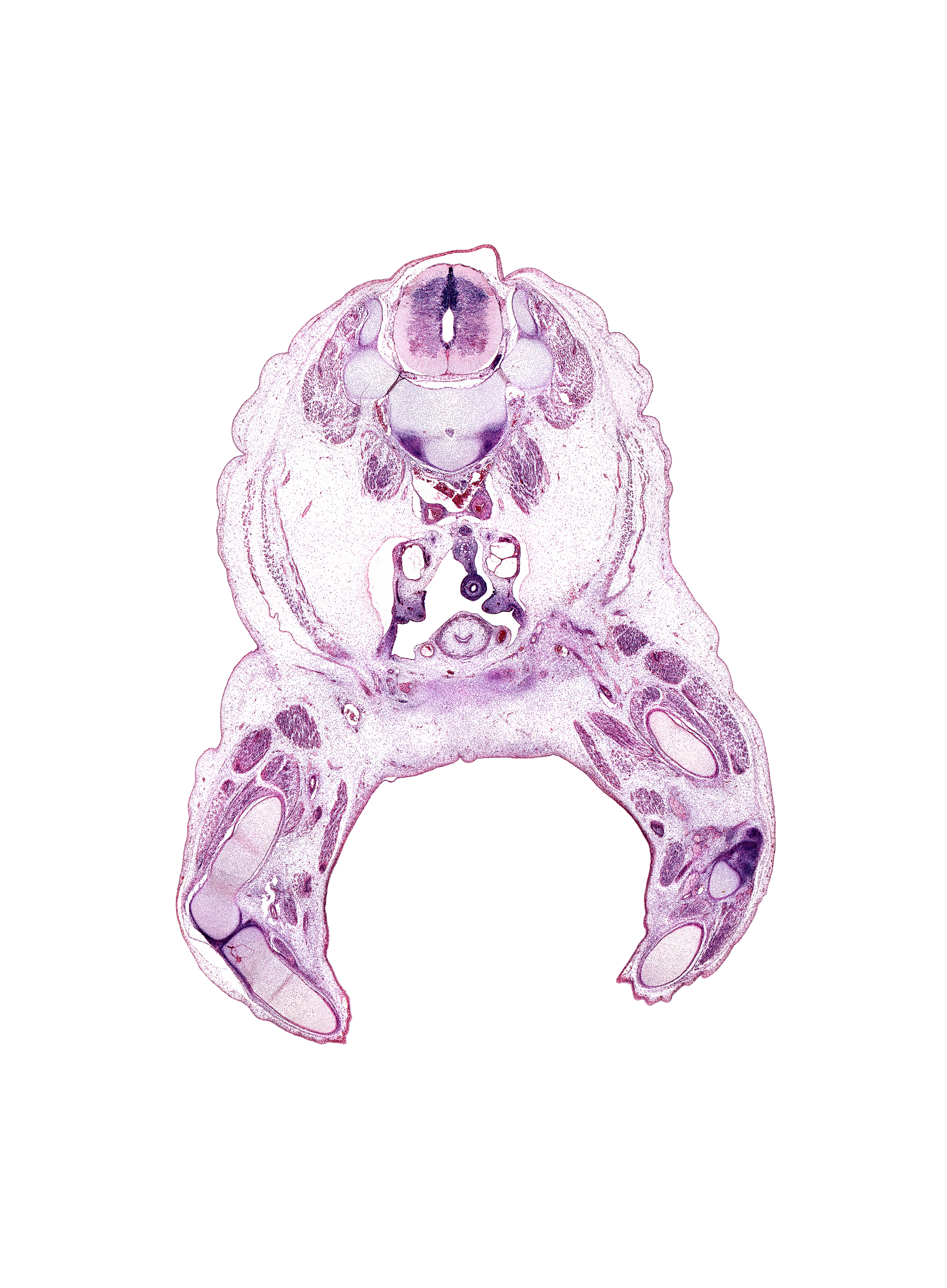 L-2 spinal ganglion, femoral artery, femur, fibula, gubernaculum of testis, hindgut, inferior mesenteric vessels, junction of common iliac veins, left common iliac artery, left umbilical artery, long saphenous vein, medial head of gastrocnemius muscle, multifidus muscle, neural arch of L-3 vertebra, peritoneal cavity, popliteal artery, rectus femoris muscle, sartorius muscle, tibia, transverse process of L-3 vertebra, vastus intermedius muscle, vastus lateralis muscle, vastus medialis muscle