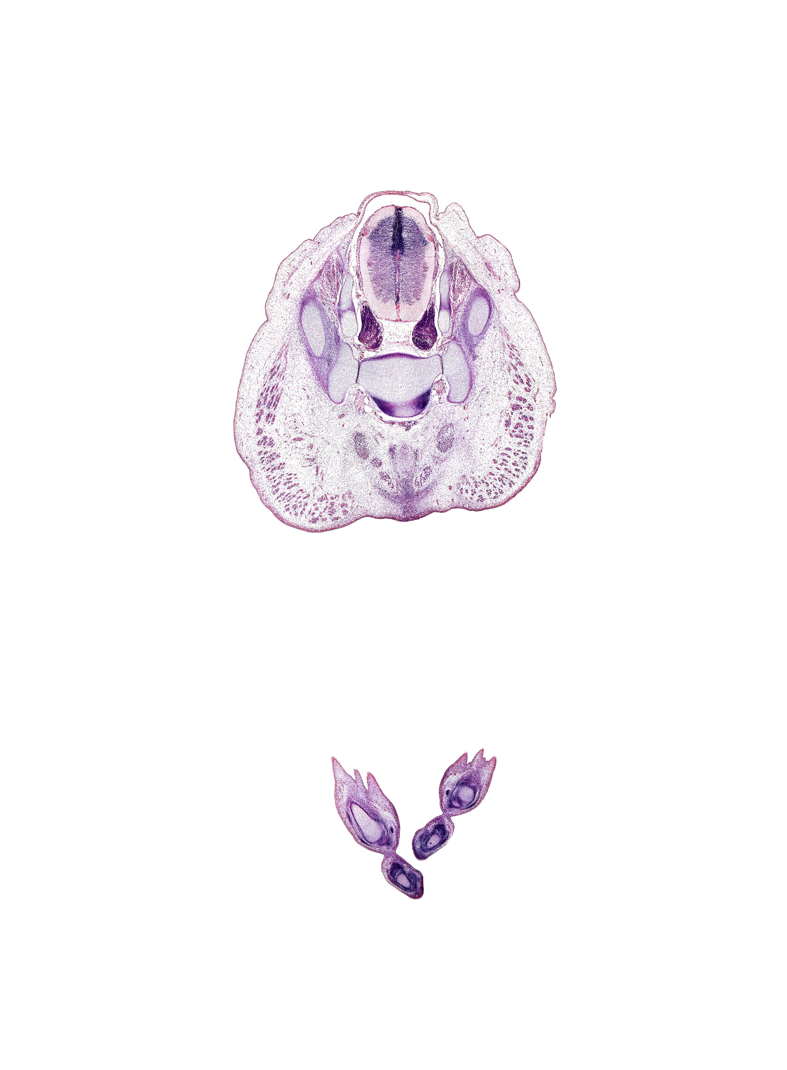 S-2 spinal ganglion, S-3 / S-4 intervertebral region, S-3 ventral primary ramus, caudal eminence, coccygeus muscle, fibularis brevis tendon, gluteus maximus muscle, ilium, levator ani muscle, metatarsal 5, metatarsal 5 head, neural arch, subarachnoid space, tuberosity