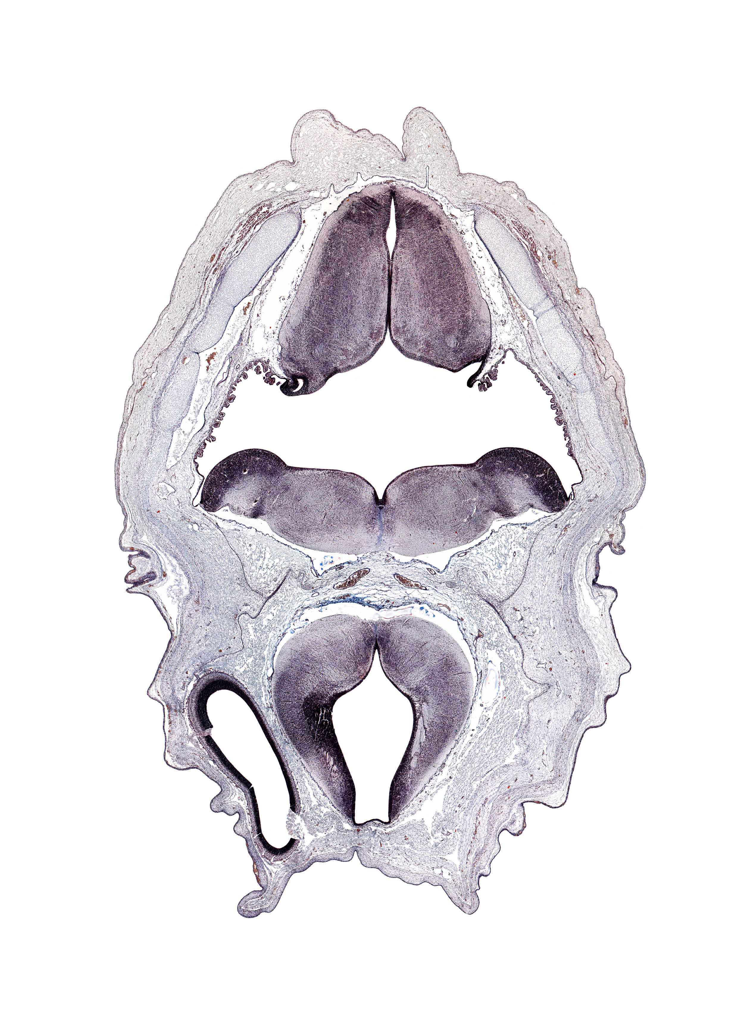 alar plate(s), facial nerve tract, hypoglossal nucleus, lateral ventricle, myelencephalon (medulla oblongata), red nucleus, roof plate of diencephalon, subarachnoid space, sulcus dorsalis, sulcus limitans, third ventricle, tractus solitarius, vestibular nucleus region