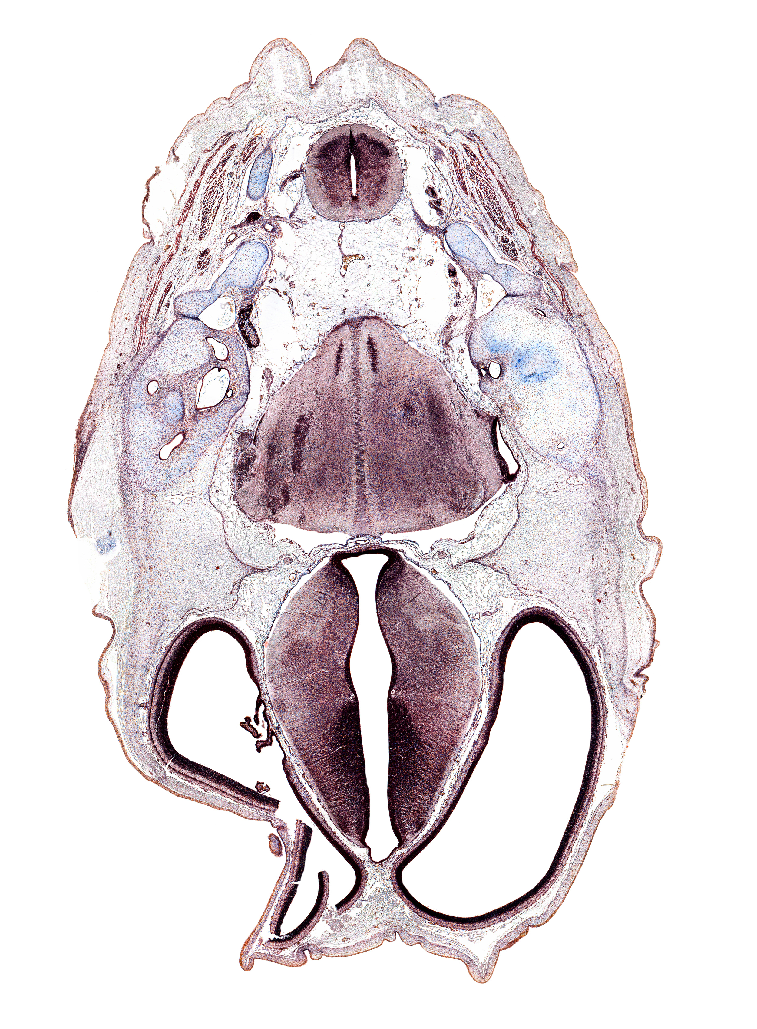C-1 spinal ganglion, anterior semicircular duct, artifact(s), cephalic edge of auricle, cerebral vesicle (telencephalon), fasciculus cuneatus, fasciculus gracilis, glossopharyngeal nerve (CN IX), insula of cerebral hemisphere, jugular foramen, medial accessory olivary nucleus, nucleus of spinal tract of trigeminal nerve, posterior arch of C-1 vertebra (atlas), posterior semicircular duct, root of vagus nerve (CN X), spinal tract of trigeminal nerve (CN V), subarachnoid space, suboccipital nerve (C-I), tract of abducens nerve (CN VI), utricle