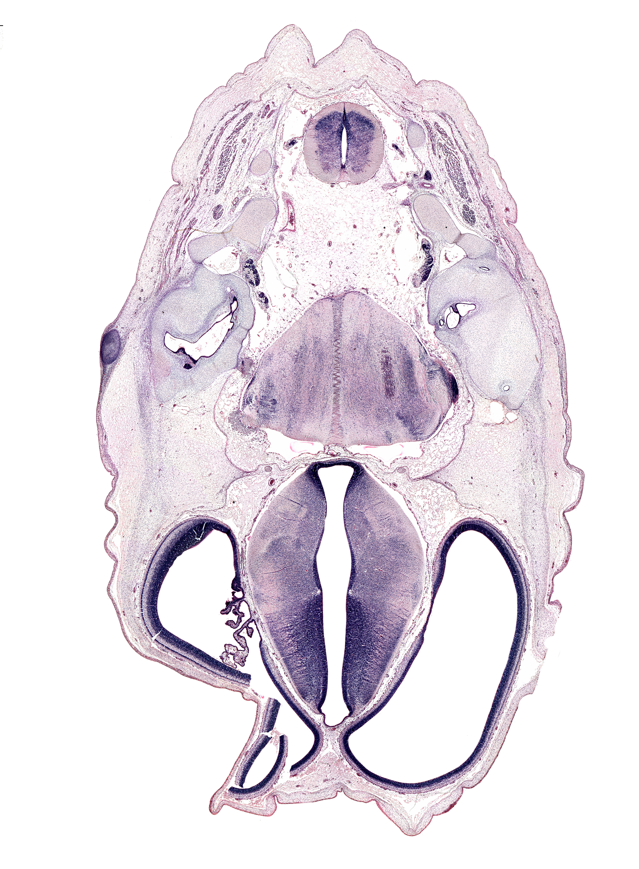 C-1 spinal ganglion, anterior semicircular duct, artifact fracture(s), central canal, cerebral vesicle (hemisphere), choroid plexus, decussation, dorsal median septum, dorsal thalamus, hypothalamus, nucleus of spinal tract of trigeminal nerve, osteogenic layer, otic capsule cartilage, pons region (metencephalon), posterior arch of C-1 vertebra (atlas), posterior communicating artery, posterior semicircular duct, semispinalis capitis muscle, spinal tract of trigeminal nerve (CN V), ventral median sulcus, ventral thalamus, vertebral artery, zona limitans intrathalamica