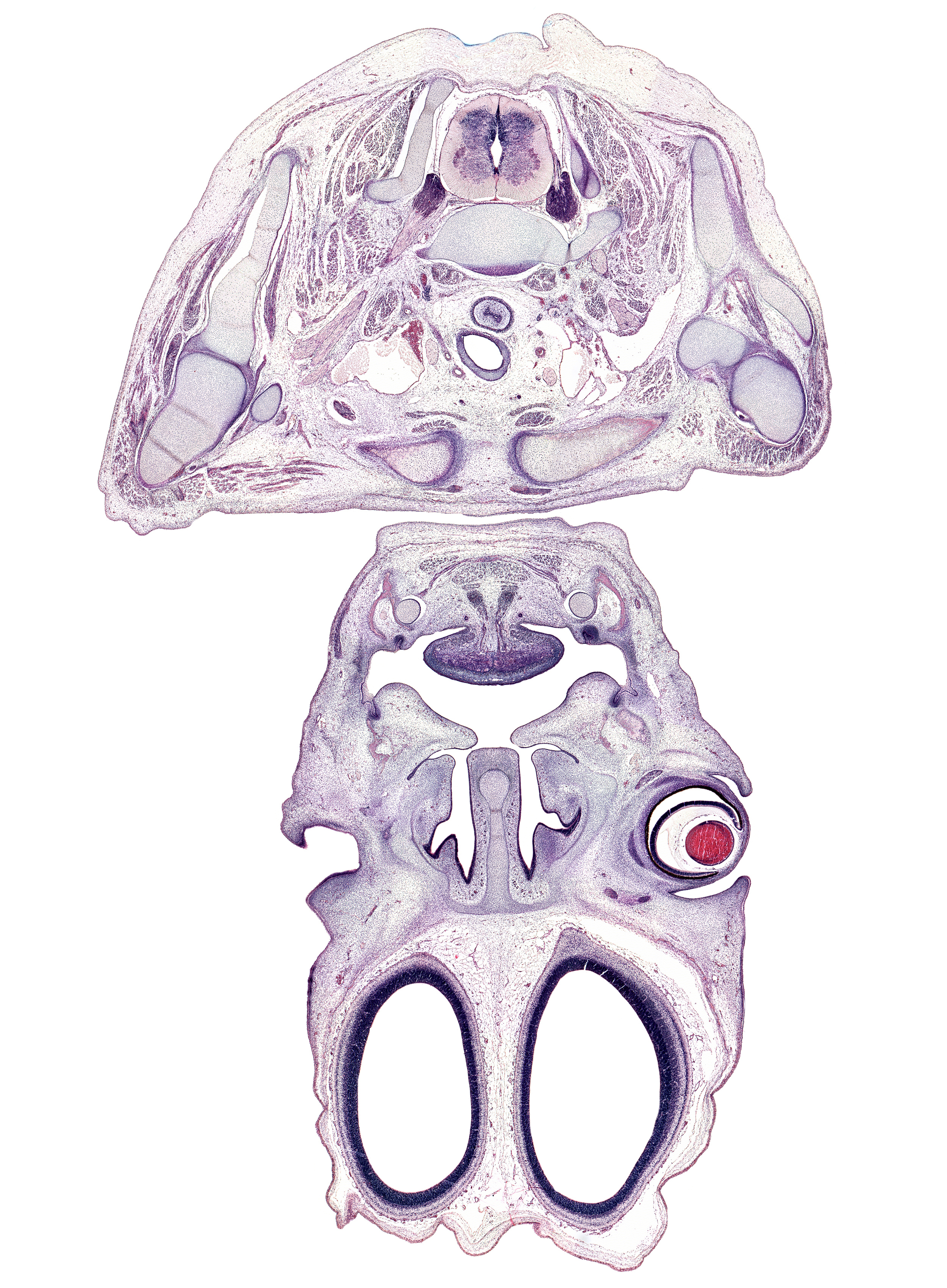C-8 spinal ganglion, anterior scalene muscle, body of tongue, centrum of C-7 vertebra, cerebral vesicle (hemisphere), clavicle, common carotid artery, coracoid process of scapula, cortical plate, dental lamina, edge of olfactory bulb, esophagus, falx cerebri region, glenohumeral joint, internal jugular vein, labiogingival lamina, middle scalene muscle, middle trunk of brachial plexus (C-7), nasal capsule cartilage, nasal septal cartilage, nasolacrimal duct, palatine shelf, rhomboid minor muscle, short head of biceps brachii muscle, sternocleidomastoid muscle, sternohyoid muscle, sternothyroid muscle, tooth bud(s), trachea, upper trunk of brachial plexus (C-5, C-6), vagus nerve (CN X)