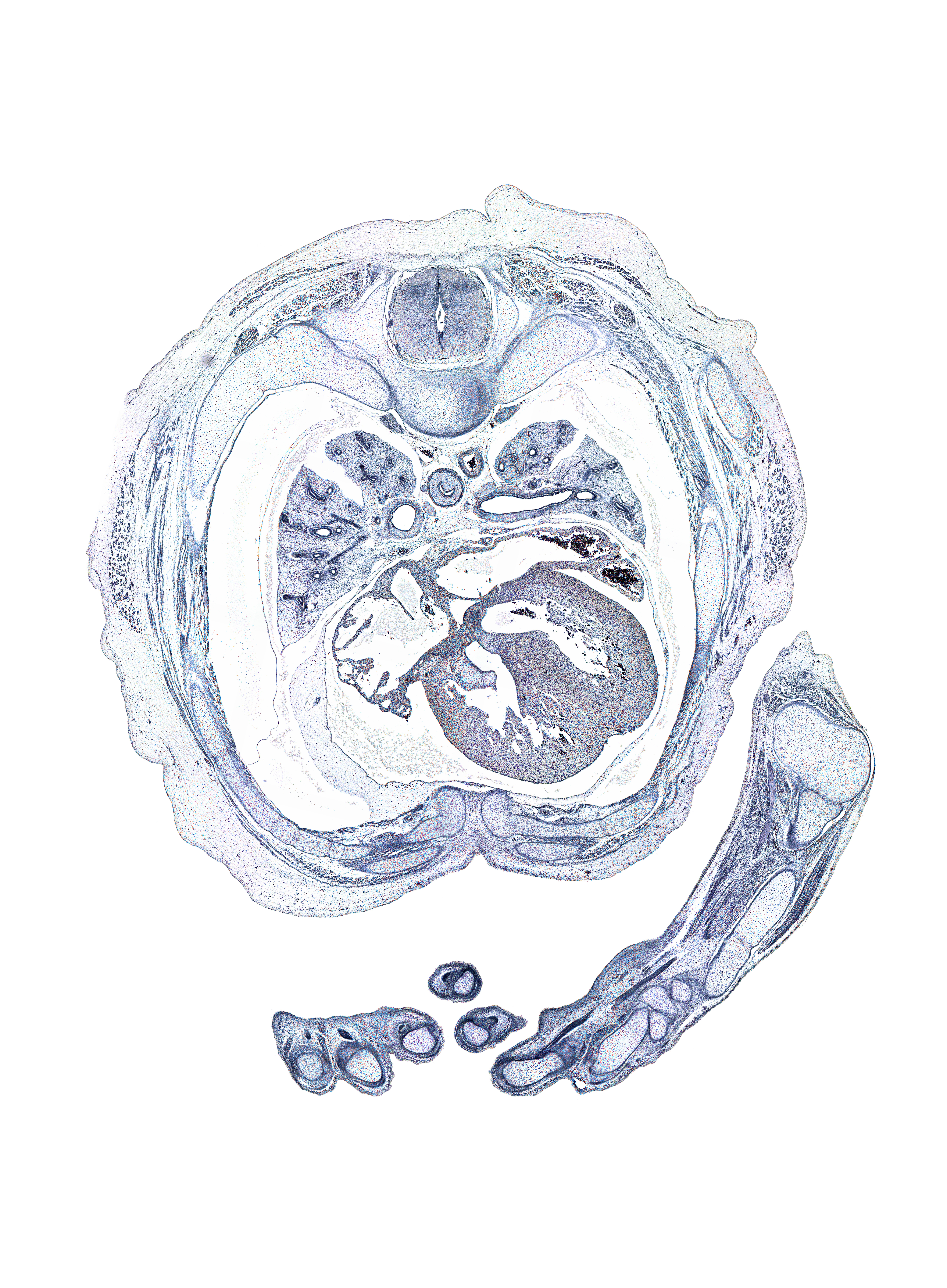 T-4 / T-5 interganglion region, aponeurosis of external abdominal oblique muscle, central canal, distal end of ulna, dorsum of hand, external intercostal muscle(s), head of radius, head of rib 5, hemisternum, humerus, iliocostalis muscle, inferior tertiary bronchus, innermost intercostal muscle(s), intermediate phalynx of left digit 2 (index finger), latissimus dorsi muscle, longissimus muscle, metacarpal 4, musculi pectinati, oblique fissure, pleural cavity, proximal phalynx of digit 3 (middle finger), radiohumeral joint, rib 5, rib 6, rib 7, serratus anterior muscle, sinus venosus, spinalis muscle, sternocostal muscle, sympathetic trunk, upper lobe of left lung, upper secondary bronchus