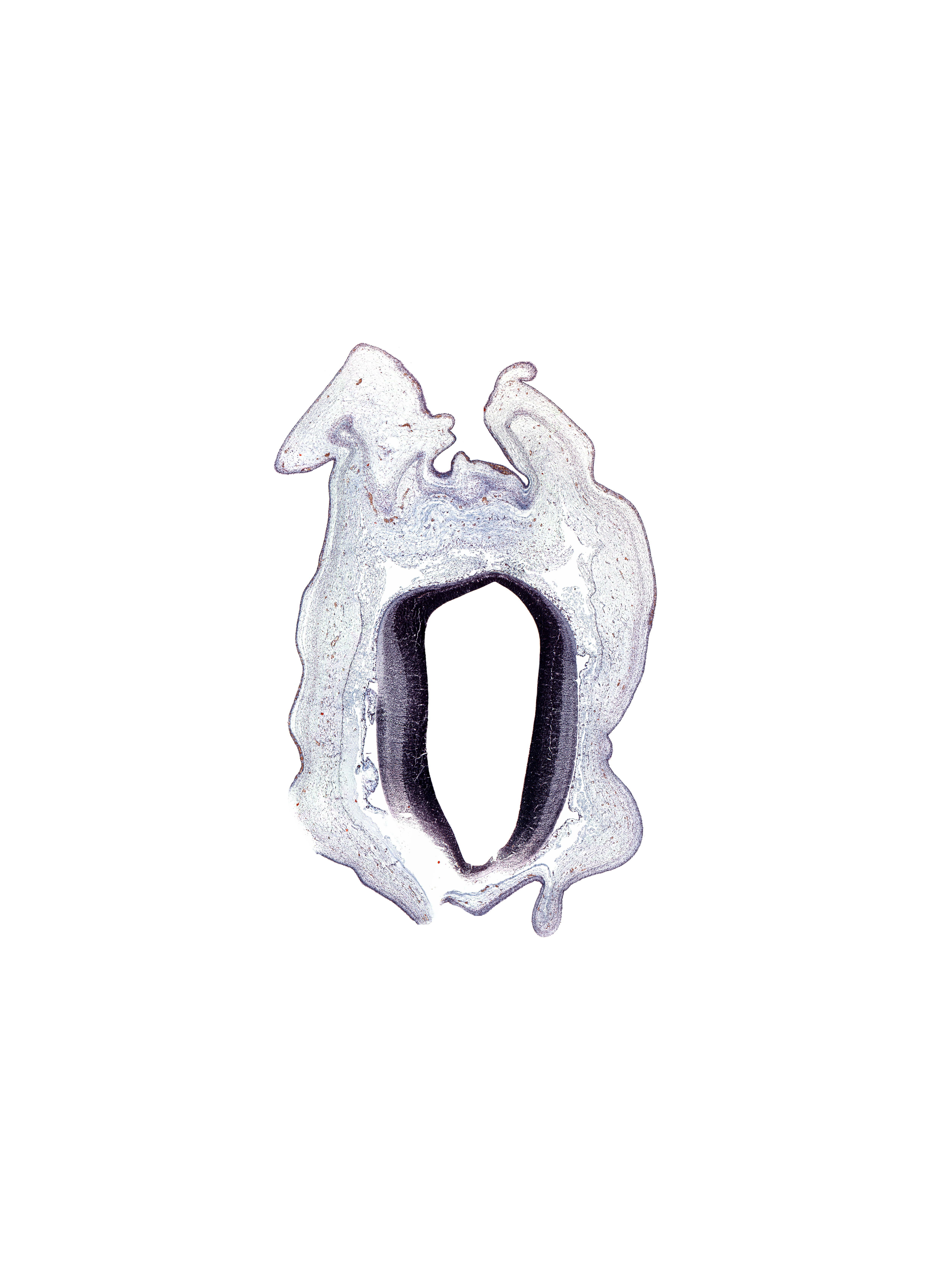 alar plate of mesencephalon, artifact(s), cerebral aqueduct (mesocoele), roof plate