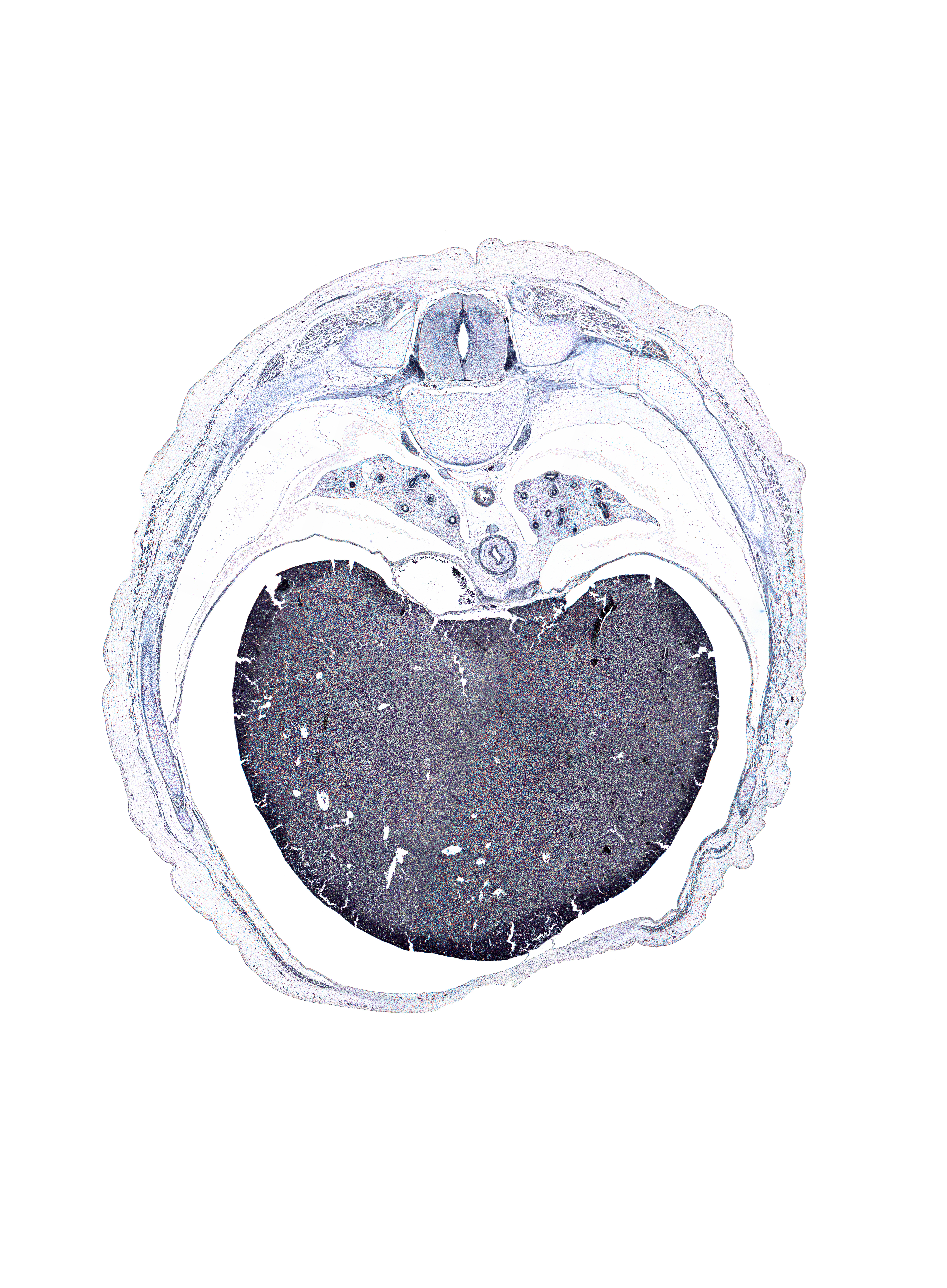 T-8 spinal ganglion, artifact(s), azygos vein anastomosis, central canal, greater splanchnic nerve, intervertebral foramen, left lobe of liver, muscular part of diaphragm, neural arch of T-8 vertebra, peritoneal cavity, pulmogenic mesenchyme, rectus abdominis muscle, rib 8, rib 9, right lobe of liver, supra-umbilical part of abdominal wall, sympathetic trunk, transverse process of T-8 vertebra