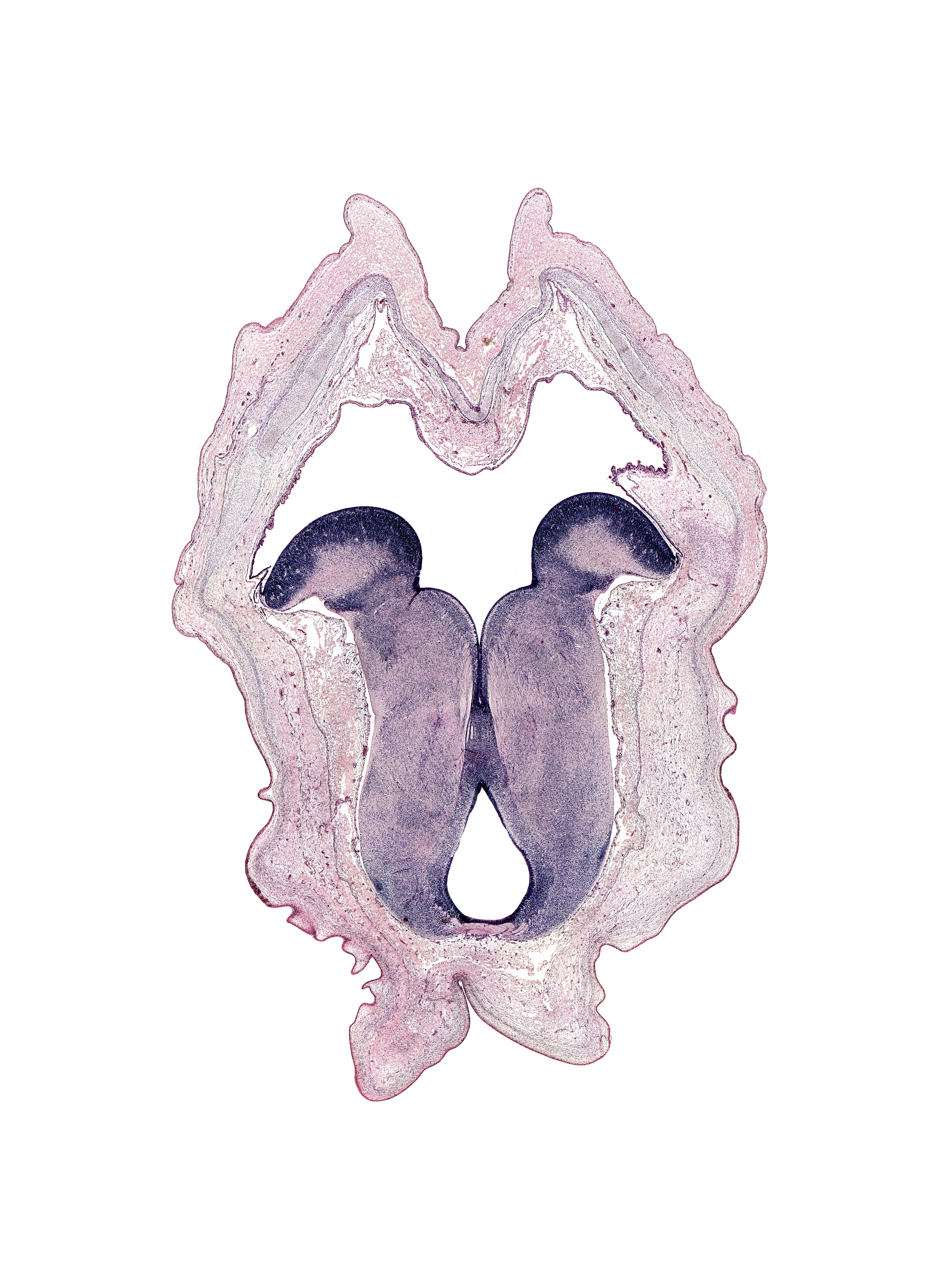 caudal part of diencephalon, facial nerve tract, junction of cerebral aqueduct and third ventricle, medial longitudinal fasciculus, posterior commissure, red nucleus, rhombencoel (fourth ventricle), vestibular area