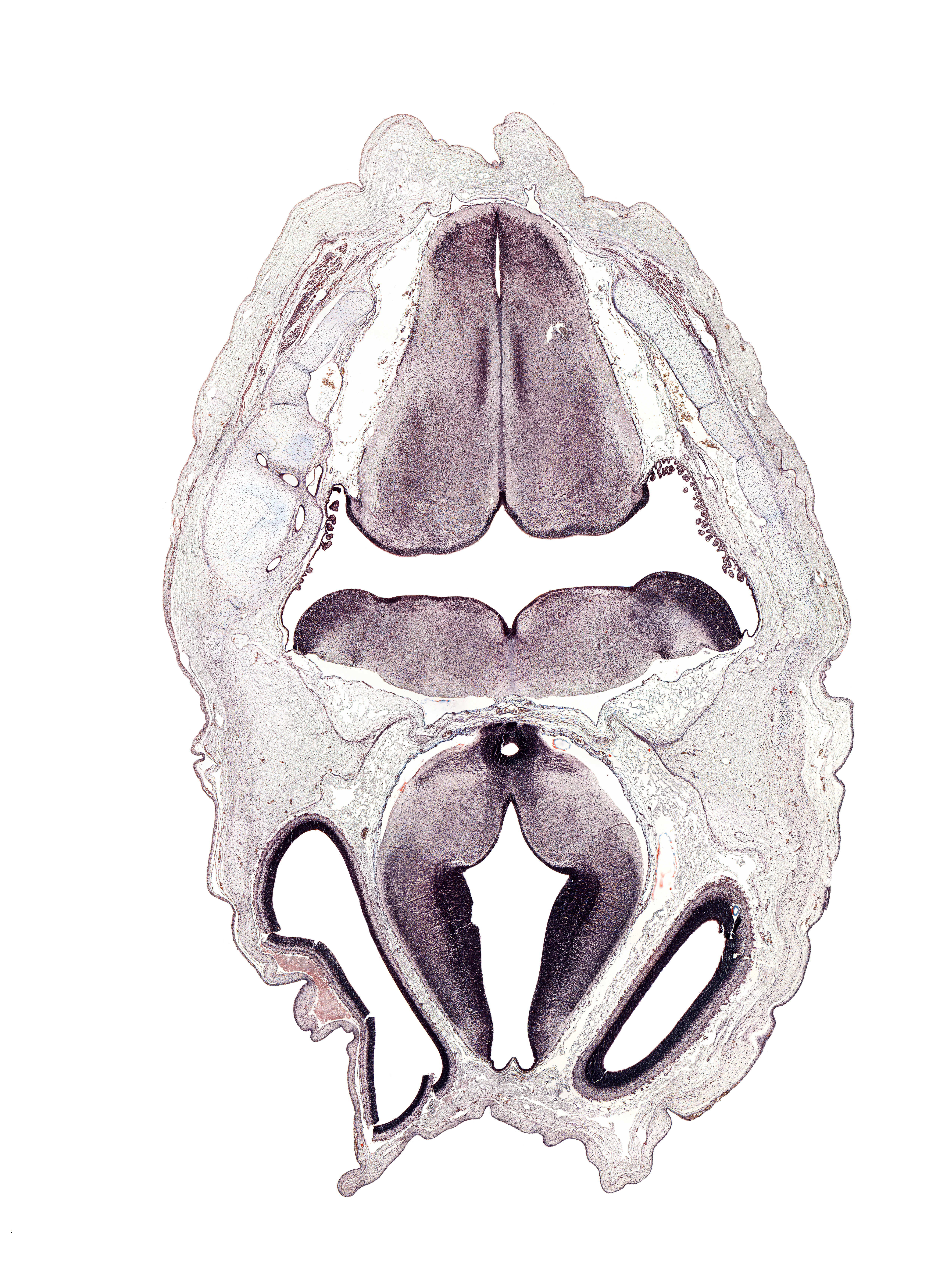 choroid plexus, diencephalon, fasciculus cuneatus, fasciculus gracilis, hypothalamic sulcus, mamillary recess, medial accessory olivary nucleus, median sulcus in floor of rhombencoel (fourth ventricle), myelencephalon (medulla oblongata), nucleus of spinal tract of trigeminal nerve, roof plate, spinal tract of trigeminal nerve (CN V), sulcus limitans, third ventricle, transverse dural sinus