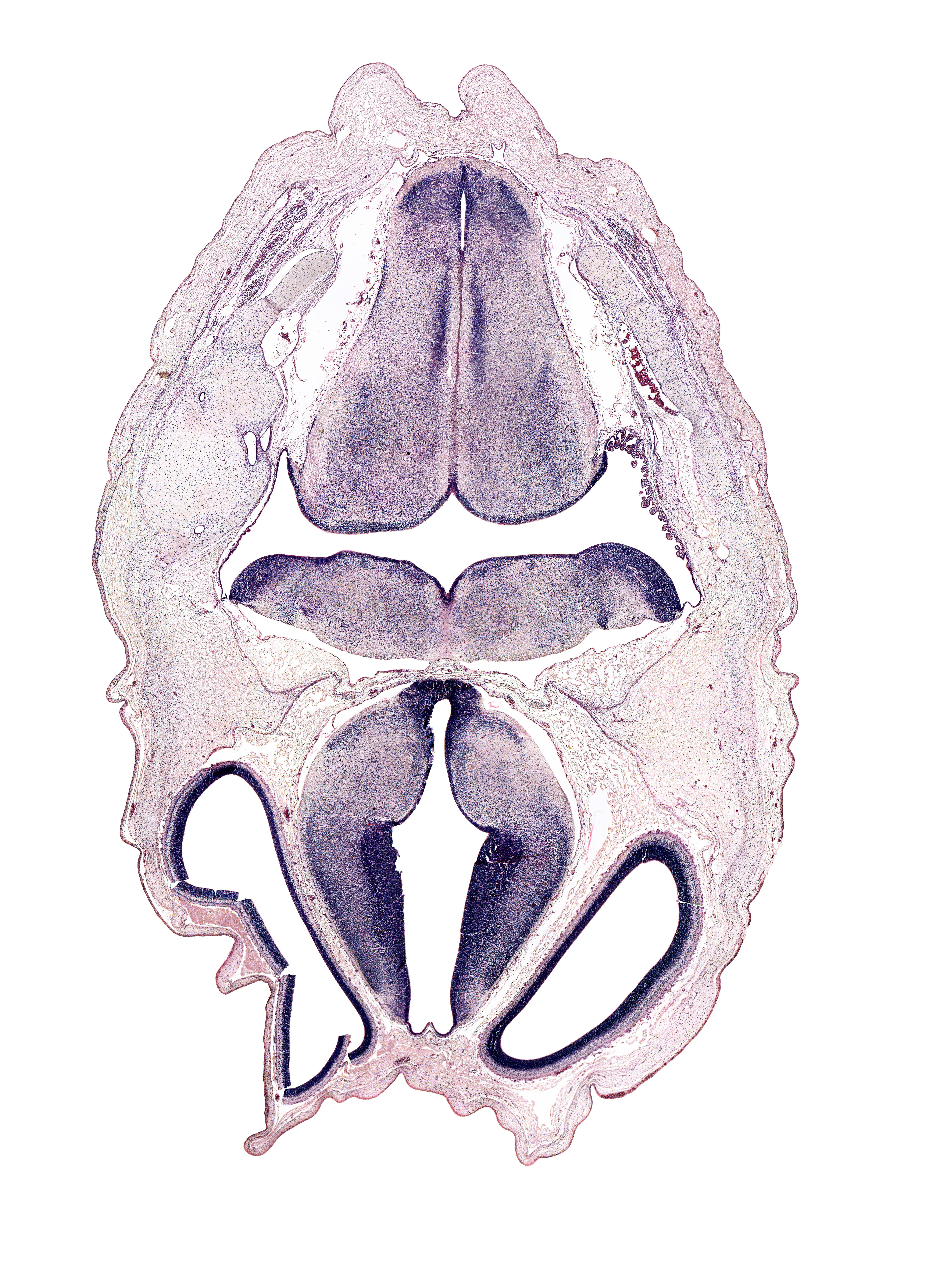 abducens nucleus, artifact fracture(s), basilar artery, central canal, cerebral vesicle (hemisphere), choroid plexus, dural band for tentorium cerebelli, endolymphatic sac, hypothalamic sulcus, hypothalamus, lateral ventricle, medial accessory olivary nucleus, medulla oblongata, rhombencoel (fourth ventricle), roof plate of diencephalon, third ventricle