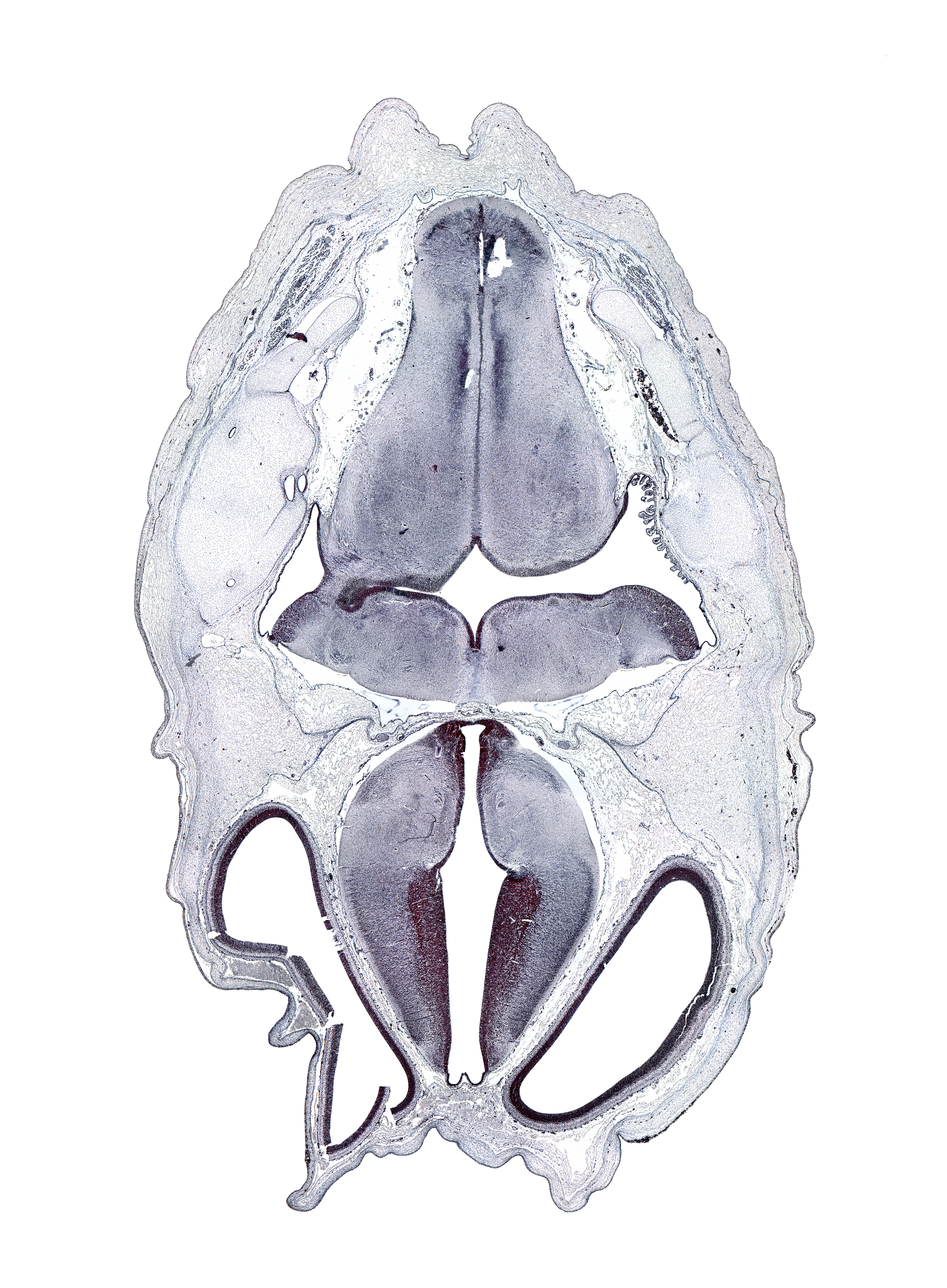 artifact space(s), artifact(s), decussation, hypothalamic sulcus, medial accessory olivary nucleus, medial longitudinal fasciculus, nucleus cuneatus, nucleus gracilis, oculomotor nerve (CN III), otic capsule cartilage, roof plate of diencephalon, sulcus dorsalis, sulcus limitans, transverse dural sinus, transverse sulcus in floor of rhombencoel (fourth ventricle)