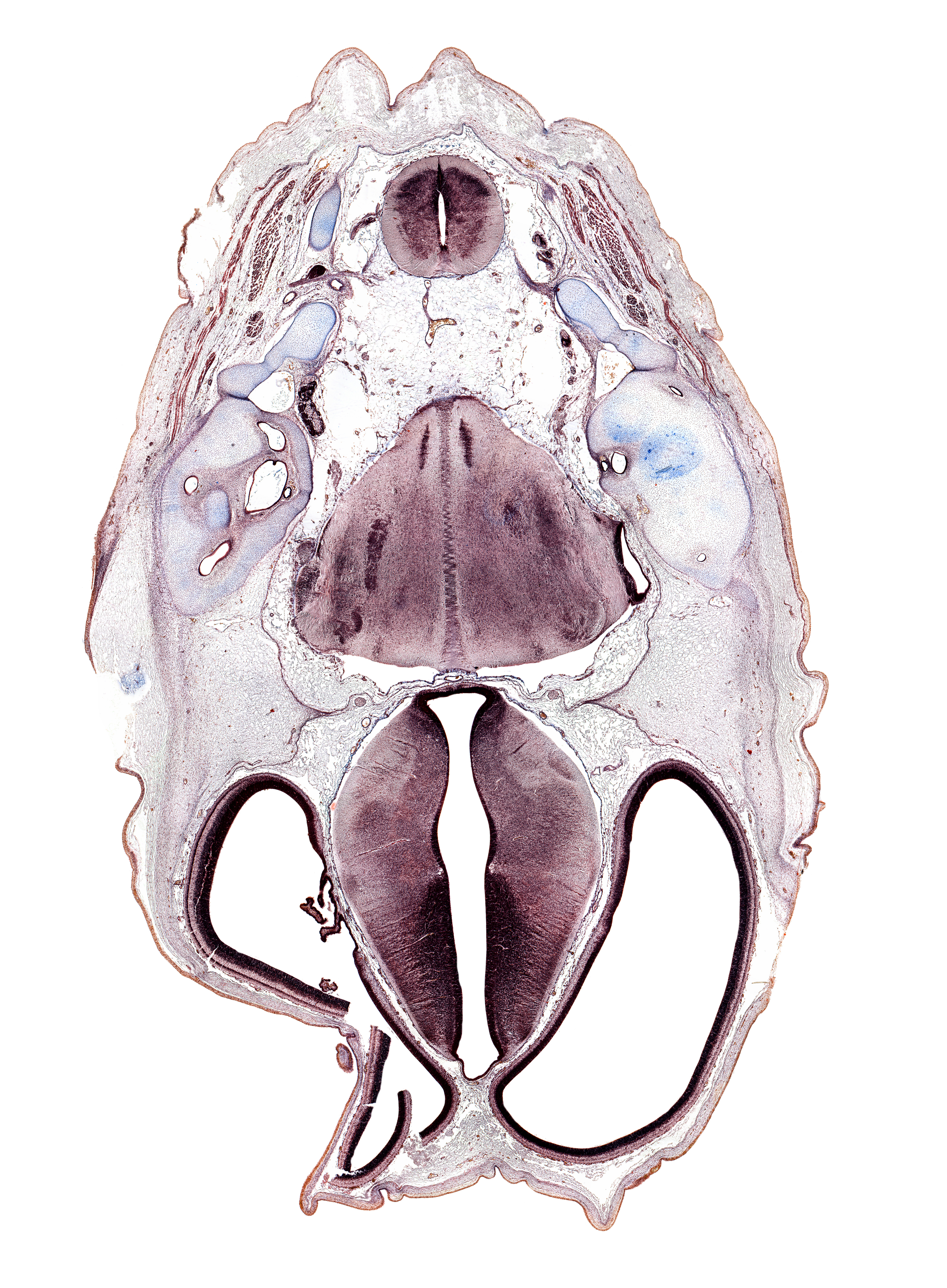 C-1 spinal ganglion, anterior semicircular duct, artifact(s), cephalic edge of auricle, cerebral vesicle (telencephalon), fasciculus cuneatus, fasciculus gracilis, glossopharyngeal nerve (CN IX), insula of cerebral hemisphere, jugular foramen, medial accessory olivary nucleus, nucleus of spinal tract of trigeminal nerve, posterior arch of C-1 vertebra (atlas), posterior semicircular duct, root of vagus nerve (CN X), spinal tract of trigeminal nerve (CN V), subarachnoid space, suboccipital nerve (C-I), tract of abducens nerve (CN VI), utricle