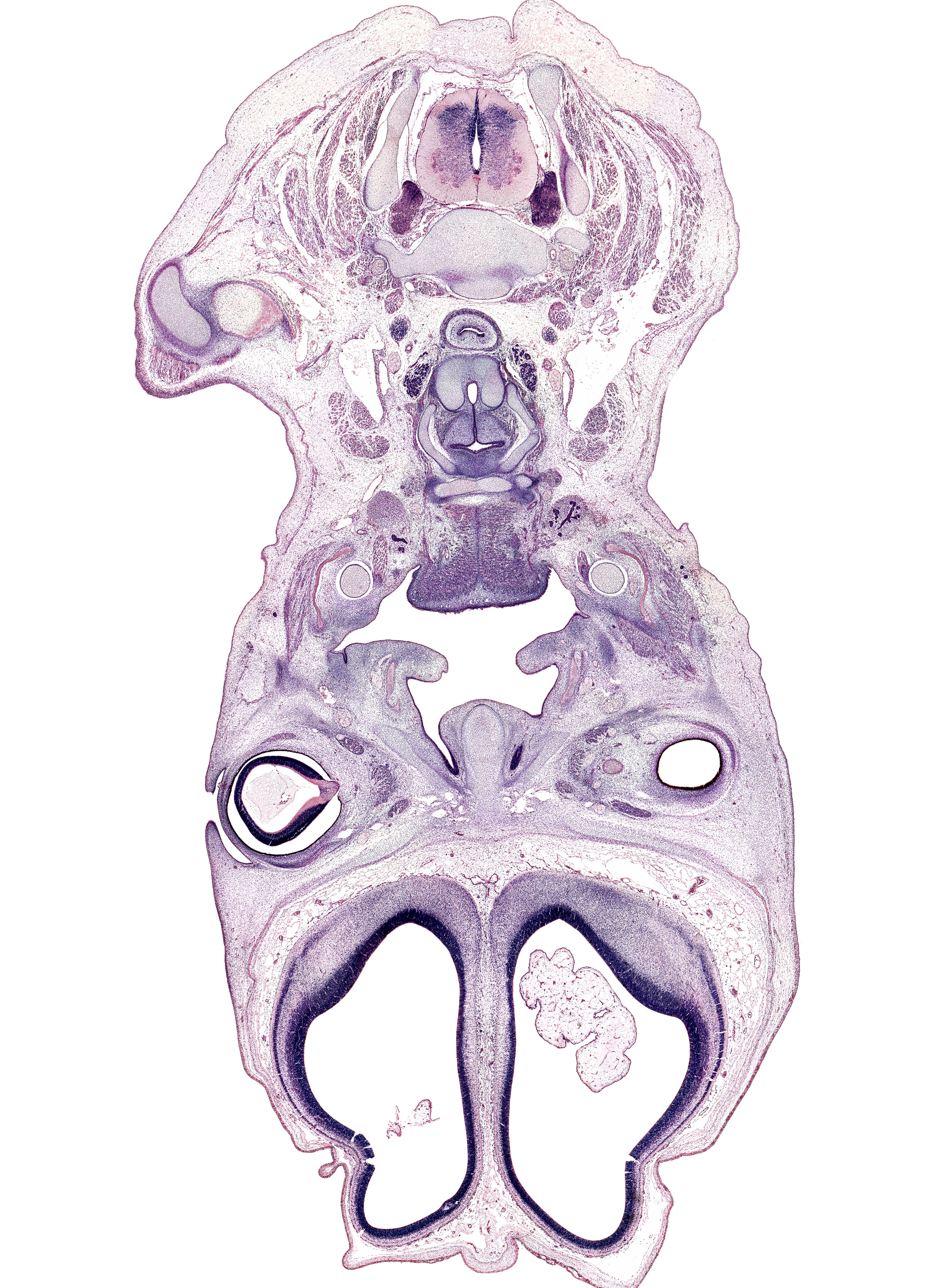 C-4 / C-5 intervertebral disc, C-5 spinal nerve, C-6 spinal ganglion, anterior communicating artery, artifact fracture(s), body of hyoid (pharyngeal arch 3 cartilage), centrum of C-5 vertebra, choroid plexus, common carotid artery, cricoid cartilage, falx cerebri region, hypoglossal nerve (CN XII), infra-orbital nerve, intraretinal space (optic vesicle cavity), jugular lymph sac, lateral ventricle, levator scapulae muscle, masseter muscle, neural layer of retina, pharyngeal arch 1 cartilage (Meckel), pigmented layer of retina, sternocleidomastoid muscle, subarachnoid space, submandibular gland, sympathetic trunk, thyroid cartilage, tongue raphe