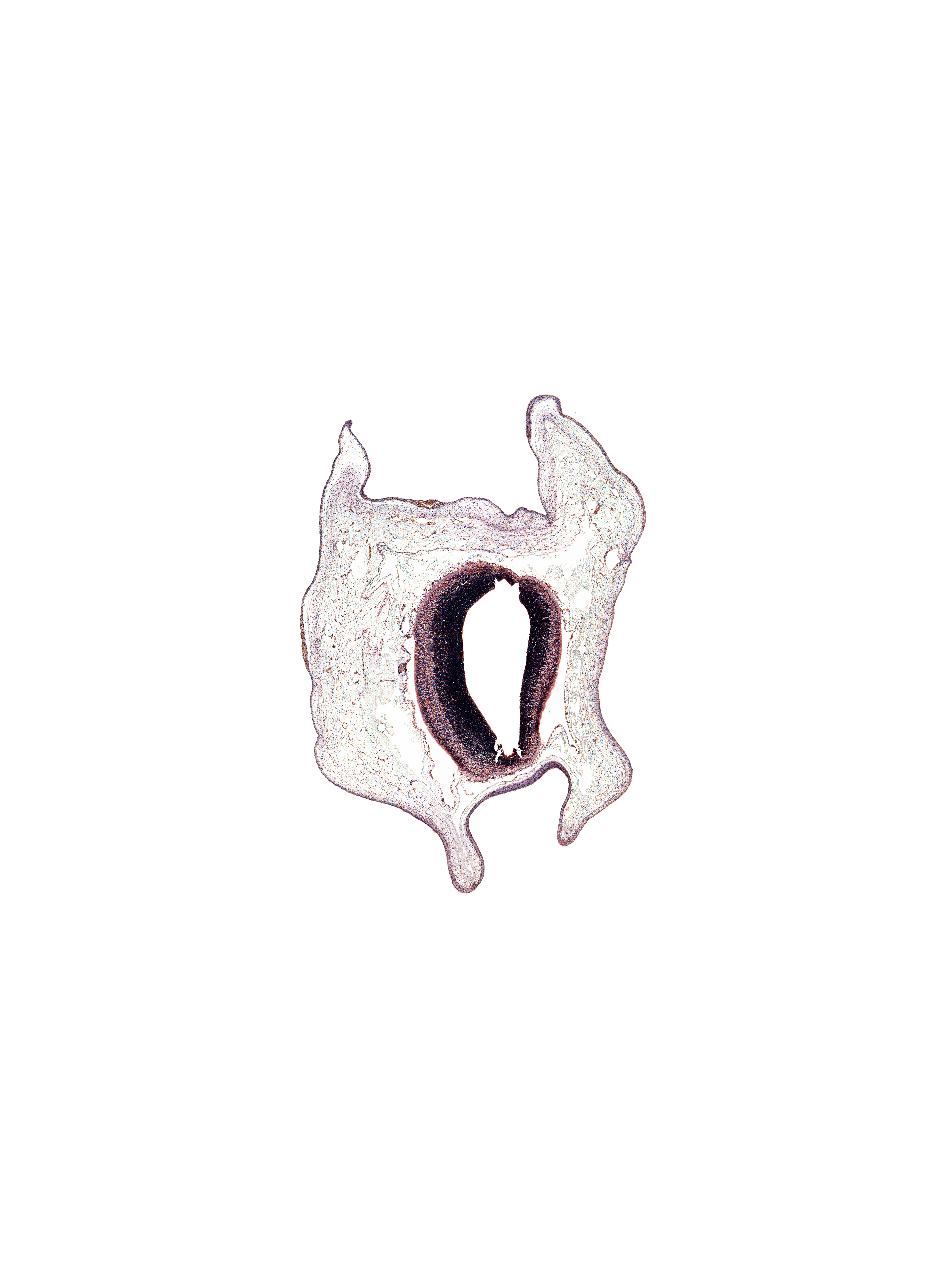 alar plate of mesencephalon, artifact space(s), artifact(s), cerebral aqueduct (mesocoele), roof plate, subarachnoid space