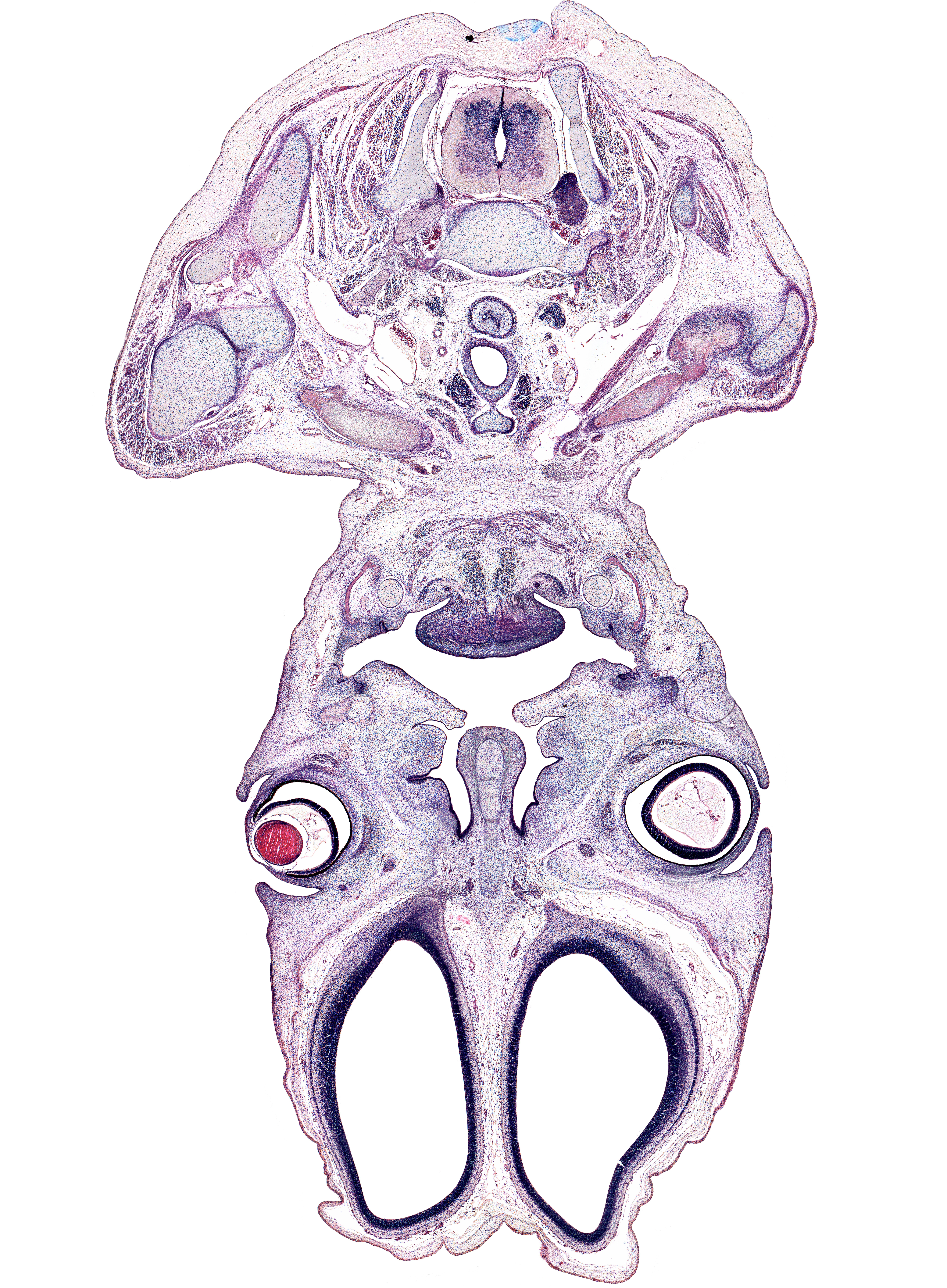 C-7 spinal ganglion, anterior belly of digastric muscle, anterior cerebral artery, centrum of C-6 vertebra, clavicle, cornea, cortical plate, falx cerebri region, geniohyoid muscle, hyaloid vessel(s), inferior nasal concha, inferior rectus muscle, intrinsic tongue muscles, lateral ventricle, left recurrent laryngeal nerve, levator scapulae muscle, longus cervicis and longus capitis muscles, lower eyelid, mandible, middle nasal concha, olfactory bulb, olfactory epithelium (placode), olfactory filia (CN I), palatine shelf, pharyngeal arch 1 cartilage (Meckel), platysma muscle, right common carotid artery, right subclavian artery, superior belly of omohyoid muscle, superior nasal concha, superior vena cava, thyroid gland, trapezius muscle, upper eyelid, vascular plexus