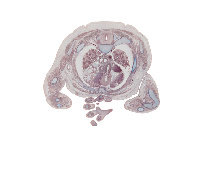 T-3 / T-4 interganglion region, ascending aorta, carina, central canal of spinal cord, centrum of T-4 vertebra, descending aorta, dorsal median septum, ductus arteriosus, extensor hood of digit 4 (ring finger), left atrium, left primary bronchus, median nerve, pectoralis major muscle, pectoralis minor muscle, pulmonary semilunar valve, pulmonary trunk, rib 3, rib 4, right atrium, right primary bronchus, right ventricle, superior vena cava, sympathetic trunk, ulnar nerve, ventral median septum, vestibule