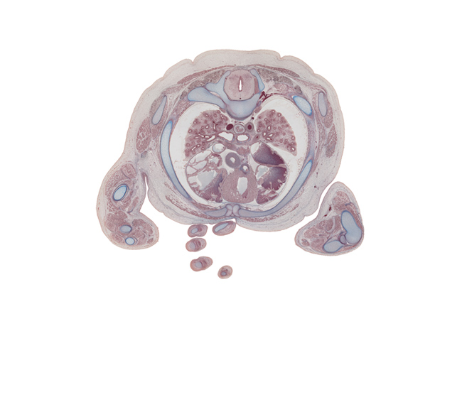 T-4 spinal ganglion, aorta, ascending aorta, azygos vein, dorsal funiculus, esophagus, head of radius, hemisternabra 3, humeroradial joint, infundibulum of right ventricle, lateral funiculus, left atrium, left primary bronchus, pericardial cavity, pleural cavity, proximal radio-ulnar joint, rhomboid major muscle, rib 3 (costal cartilage), rib 4, right anterior segmental bronchus of upper lobe, right atrium, right primary bronchus, sympathetic trunk, tendons of flexor digitorum muscles of digit 4 (ring finger), trapezius muscle, ulna, ulnar nerve, ventral funiculus