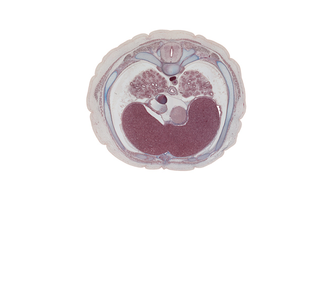 T-6 / T-7 interganglion region, T-6 / T-7 intervertebral disc, central tendon of diaphragm, costodiaphragmatic recess, head of rib 7, inferior vena cava, latissimus dorsi muscle, left lobe of liver, left vagus nerve (CN X), left ventricle, lower lobe of left lung, lower lobe of right lung, notochord, pericardial cavity, posterior intercostal artery, rectus abdominis muscle, rib 7, right atrium, right lobe of liver, serratus anterior muscle, sympathetic trunk, thoracolumbar fascia, trapezius muscle