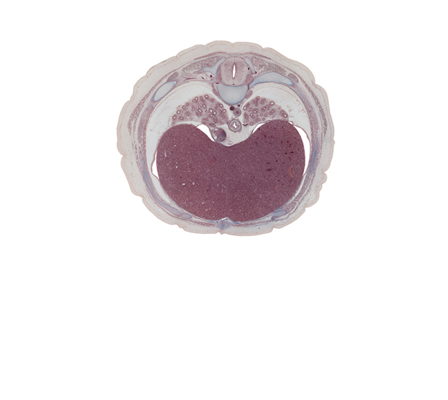 T-7 spinal ganglion, caudal edge of pericardial cavity, dorsal horn of grey matter, iliocostalis muscle, inferior vena cava, lateral horn of grey matter, latissimus dorsi muscle, left lobe of liver, linea alba, longissimus muscle, lower lobe of left lung, lower lobe of right lung, parietal pleura, peritoneal cavity, pleural cavity, rib 8, right lobe of liver, serratus anterior muscle, spinalis muscle, trapezius muscle, ventral horn of grey matter