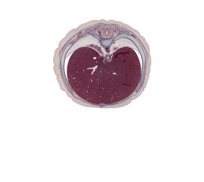 T-8 / T-9 interganglion region, T-8 / T-9 intervertebral disc, anterior gastric nerve (CN X), caudal edge of left lung, central canal of spinal cord, diaphragm, dorsal horn of grey matter, ductus venosus, efferent hepatic vein, esophageal hiatus in diaphragm, head of rib 9, iliocostalis muscle, inferior vena cava, left hepatic vein tributary (revehente vein), longissimus muscle, muscular part of diaphragm, neural arch, peritoneal cavity, posterior gastric nerve (CN X), rib 9, right hepatic vein, sympathetic trunk, transversospinalis muscle