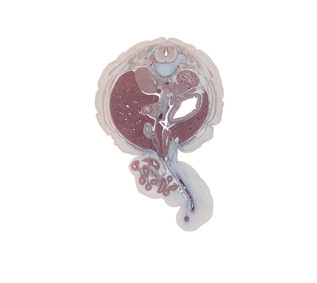 T-11 / T-12 interganglion region, body of dorsal pancreas, caudal edge of pleural recess, cephalic edge of jejunum, colon, descending part of duodenum, diaphragm, gall bladder, head of ventral pancreas, ileum, inferior vena cava, kidney (metanephros), left umbilical artery, lesser sac (omental bursa), mesentery, notochord, origin of left renal artery, origin of right renal artery, stomach, superior mesenteric artery, superior mesenteric vein, superior mesenteric vessels, suprarenal gland cortex, tail of dorsal pancreas, umbilical coelom, umbilical cord, umbilical vein, umbilical vesicle stalk