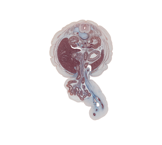 L-1 spinal ganglion, L-1 spinal nerve, allantoic vesicle(s), ascending part of duodenum, caudal edge of gall bladder, colon, descending part of duodenum, extension of umbilical coelom, external abdominal oblique muscle, herniated intestines, inferior vena cava, internal abdominal oblique muscle, jejunum, kidney (metanephros), left umbilical artery, notochord, rectus abdominis muscle, right umbilical artery, spinalis muscle, superior major calyx, suspensory ligament of duodenum, transversospinalis muscle, transversus abdominis muscle, umbilical cord, umbilical vein, umbilical vesicle stalk, urachus