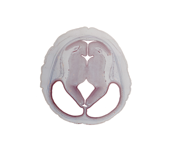 cerebellum, cerebral aqueduct (mesocoele), cerebral hemisphere, dorsal thalamus, epidermis, lateral ventricle, median sulcus, rhombencoel (fourth ventricle), subarachnoid space, subcutaneous tissue, third ventricle