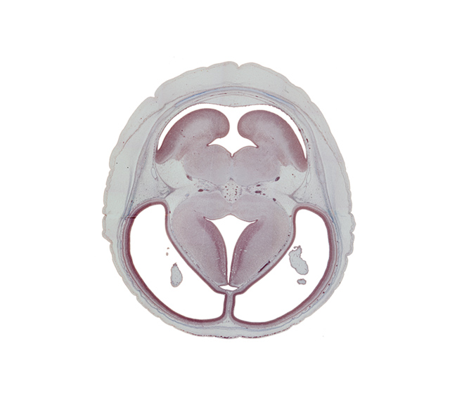 alar plate(s), basal plate, basis pedunculi of pons region (metencephalon), dorsal thalamus, dural limiting layer, hypothalamic sulcus, interpeduncular fossa, lateral ventricle, medial wall of cerebral hemisphere, mesencephalic artery, origin of oculomotor nerve (CN III), osteogenic layer, pyramidal tract region, rhombencoel (fourth ventricle), rhombic lip, subarachnoid space, sulcus limitans, superior cerebellar artery, third ventricle, trochlear nerve (CN IV), ventral thalamus