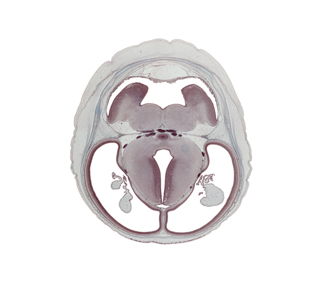 basilar artery, basis pedunculi of pons region (metencephalon), decussation, diverticulum, dorsal thalamus, hypothalamic sulcus, inferior sagittal sinus, mamillary body, median sulcus, oculomotor nerve (CN III), posterior cerebral artery, posterior communicating artery, roof of rhombencoel (fourth ventricle), subarachnoid space, sulcus dorsalis, sulcus limitans, superior cerebellar artery, superior sagittal sinus, trochlear nerve (CN IV), ventral thalamus