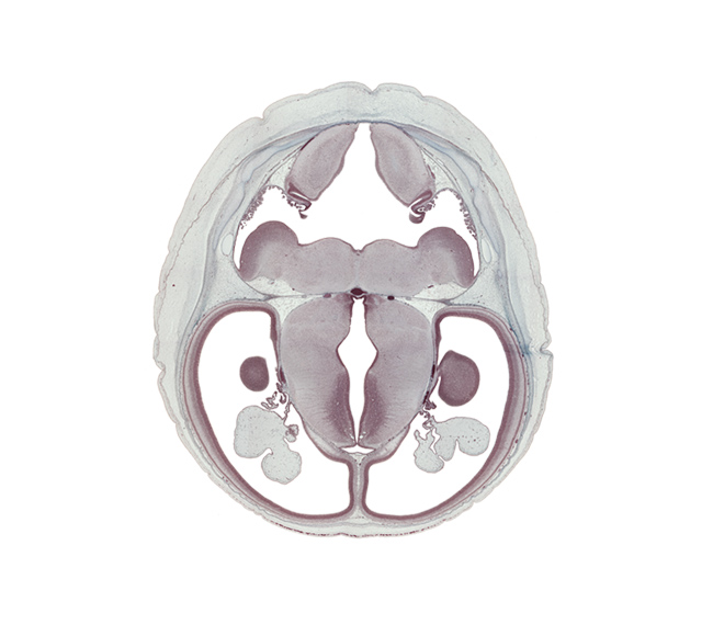 basilar artery, choroid plexus, dorsal thalamus, dural band for tentorium cerebelli, edge of ventricular eminence(s), hypothalamic sulcus, hypothalamus, oculomotor nerve (CN III), rhombencoel (fourth ventricle), sulcus dorsalis, trochlear nerve (CN IV), ventral thalamus