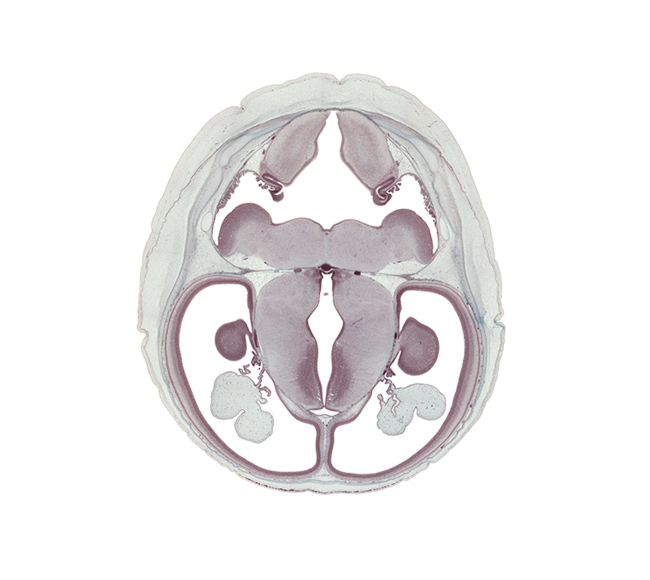 anterior choroidal artery, basilar artery, choroid plexus, dorsal thalamus, hippocampus, hypothalamic sulcus, hypothalamus, inferior sagittal sinus, intermediate zone, lateral ventricle, lateral ventricular eminence (telencephalon), marginal ridge, marginal zone, medial ventricular eminence (diencephalon), medulla oblongata, oculomotor nerve (CN III), posterior communicating artery, roof of rhombencoel (fourth ventricle), sulcus limitans, trochlear nerve (CN IV), ventricular zone, vestibular nucleus region