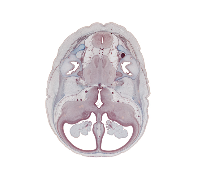 accessory nerve (CN XI), alar plate(s), anterior commissure region, basal plate, basilar artery, central canal, decussation, endolymphatic duct, glossopharyngeal nerve (CN IX), hippocampus, hypothalamus, insula of cerebral hemisphere, internal carotid artery, jugular foramen, junction of anterior semicircular duct and utricle, lateral ventricular eminence (telencephalon), medial ventricular eminence (diencephalon), medulla oblongata, middle cerebral artery, oculomotor nerve (CN III), optic groove, posterior semicircular duct, region of cervical flexure, root of trigeminal nerve (CN V), sulcus limitans, trochlear nerve (CN IV), tuberal part of adenohypophysis, utricle, vagus nerve (CN X), vestibulocochlear nerve (CN VIII)