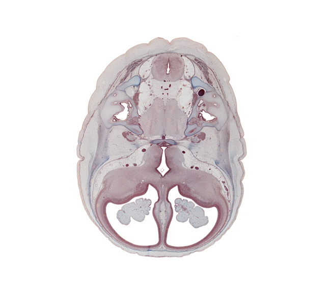 anterior inferior cerebellar artery, anterior semicircular duct, anterior spinal artery, basilar artery, cephalic edge of cochlear duct, choroid plexus, dorsum sellae, edge of lesser wing of sphenoid, hippocampus, junction of endolymphatic duct and utricle, lateral semicircular duct, lateral ventricle, medulla oblongata, neurohypophysis, optic groove, optic tract, otic capsule, petrous part of temporal bone (otic capsule), pons region (metencephalon), posterior inferior cerebellar artery, posterior semicircular duct, pyramidal tract region, root of hypoglossal nerve (CN XII), sensory decussation, tuberal part of adenohypophysis