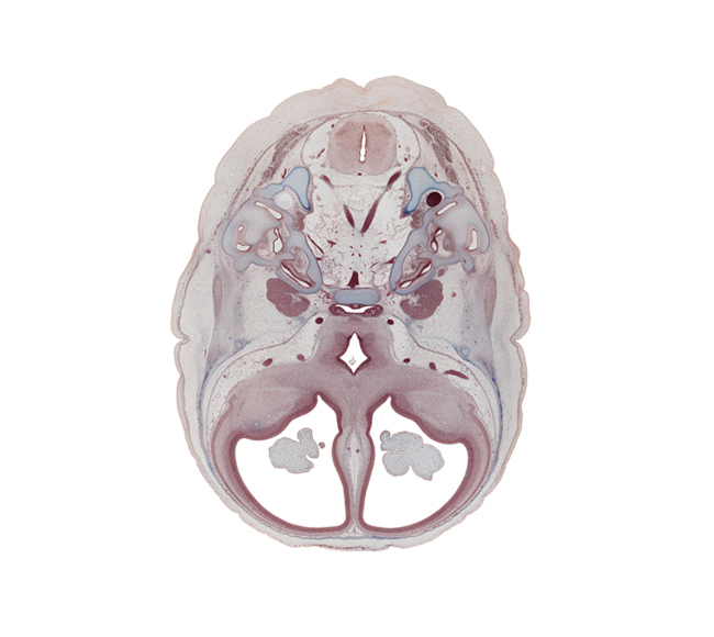 abducens nerve (CN VI), adenohypophysis (intermediate part), anterior spinal artery, basilar artery, basisphenoid, caudal part of medulla oblongata, cochlear duct, foramen magnum, hypothalamus, junction of cochlear duct and saccule, junction of internal jugular vein and sigmoid sinus, labrynthine artery, lateral semicircular duct, lateral ventricle, middle cerebral artery, neurohypophysis, optic groove, optic tract, piriform cortex (paleopallium), posterior semicircular duct, superior ganglion of glossopharyngeal nerve (CN IX), superior ganglion of vagus nerve (CN X), third ventricle, vertebral artery