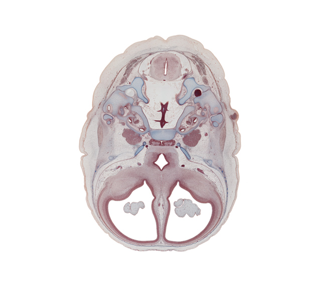 anterior spinal artery, basilar artery, basisphenoid, central canal, cochlear duct, distal part of adenohypophysis, facial nerve (CN VII), foramen magnum, frontal bone ossification, geniculate ganglion (CN VII), hippocampus, internal carotid artery, jugular foramen, junction of brain and spinal cord, junction of vertebral arteries, lateral semicircular duct, lateral ventricular eminence (telencephalon), lesser wing of sphenoid, medial ventricular eminence (diencephalon), middle cerebral artery, nucleus accumbens, optic groove, residual lumen, semispinalis capitis muscle, splenius muscle, stapes, subarachnoid space, sulcus terminalis, vertebral artery