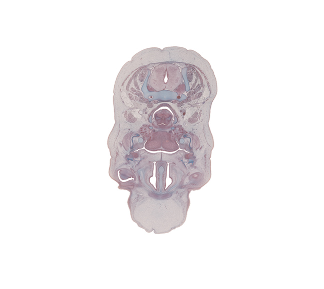 C-5 spinal ganglion, body of tongue, common carotid artery, conjunctival sac, edge of eyeball, fusion region of palatine shelves, greater horn of hyoid (pharyngeal arch 3 cartilage), internal jugular vein, interorbital ligament, jugular lymph sac, lesser horn of hyoid (pharyngeal arch 2 cartilage), linguogingival sulcus, lymph sac, masseter muscle, middle pharyngeal constrictor muscle, parotid duct, platysma muscle, retropharyngeal space, sternocleidomastoid muscle, sympathetic trunk, vagus nerve (CN X)