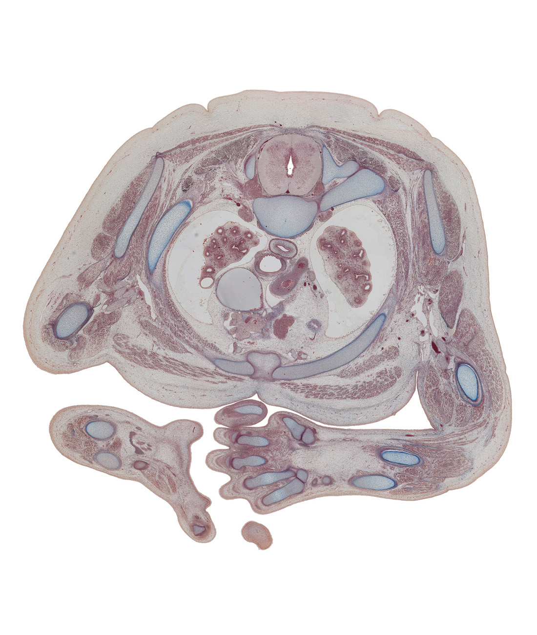 T-2 spinal ganglion, arch of aorta, central canal of spinal cord, costotransverse joint, dorsal funiculus, dorsal horn of grey matter, edge of pericardial cavity, edge of right atrium, esophagus, extensor muscle(s), humerus, interosseus muscle, left lobe of thymus gland, manubrosternal joint, metacarpal 5, neck of rib 3, radius, rib 2, scapula, trachea, ulna, upper lobe of left lung, upper lobe of right lung