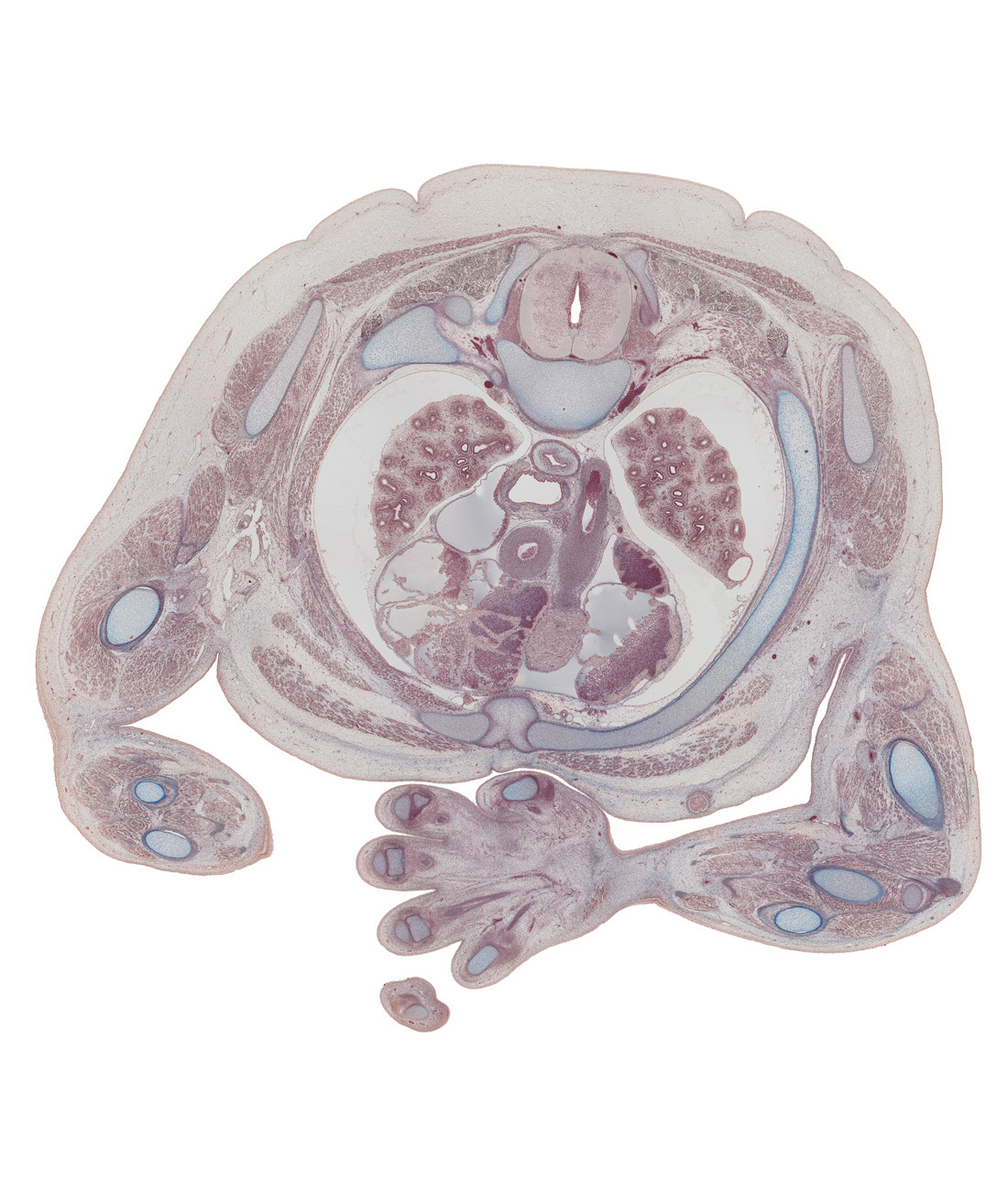 T-3 spinal ganglion, body of sternum, brachialis muscle, brachioradialis muscle, descending aorta, ductus arteriosus, edge of right ventricle, esophagus, forearm flexor muscles, humerus, left atrium, proximal interphalangeal joint of digit 4 (ring finger), radius, rhomboid major muscle, rib 3, right atrium, scapula, subscapularis muscle, superior hemi-azygos vein, supraspinatus muscle, thenar muscle, trachea, trapezius muscle, ulna